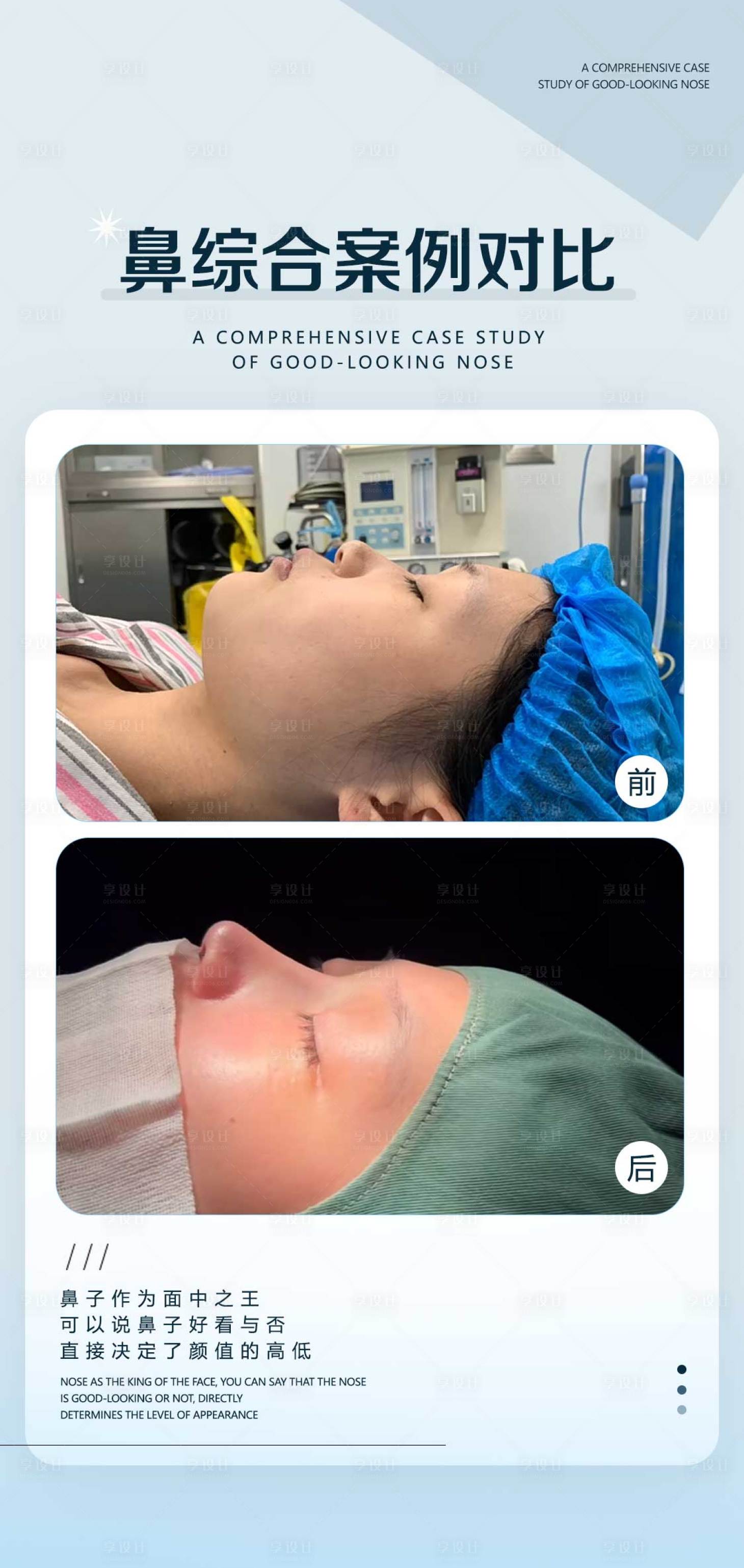 源文件下载【享设计】搜索编号：99820024558569375【医美案例美业案例对比】