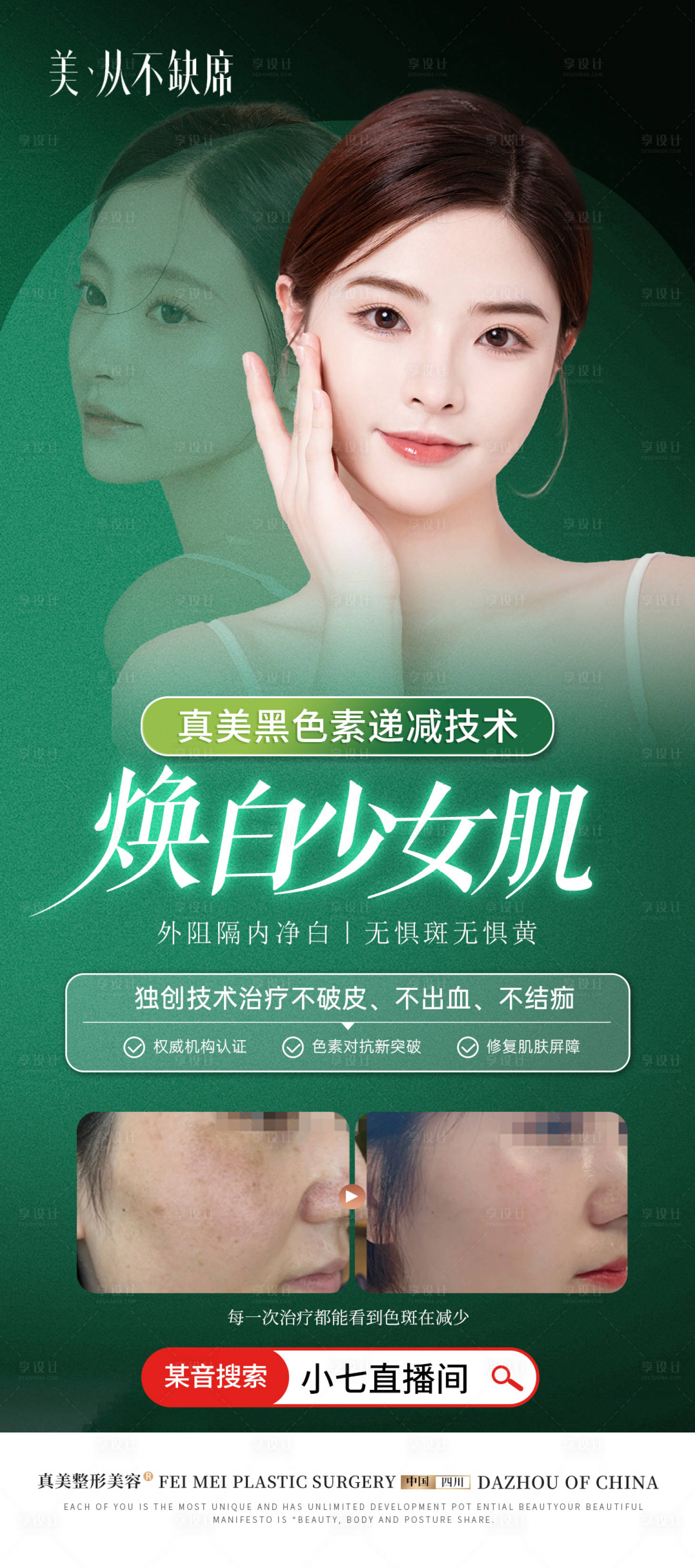 源文件下載【享設(shè)計】搜索編號：98780024425426363【醫(yī)美祛斑高級海報】