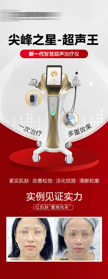 源文件下載【享設計】搜索編號：47260024744888096【超聲王儀器海報】