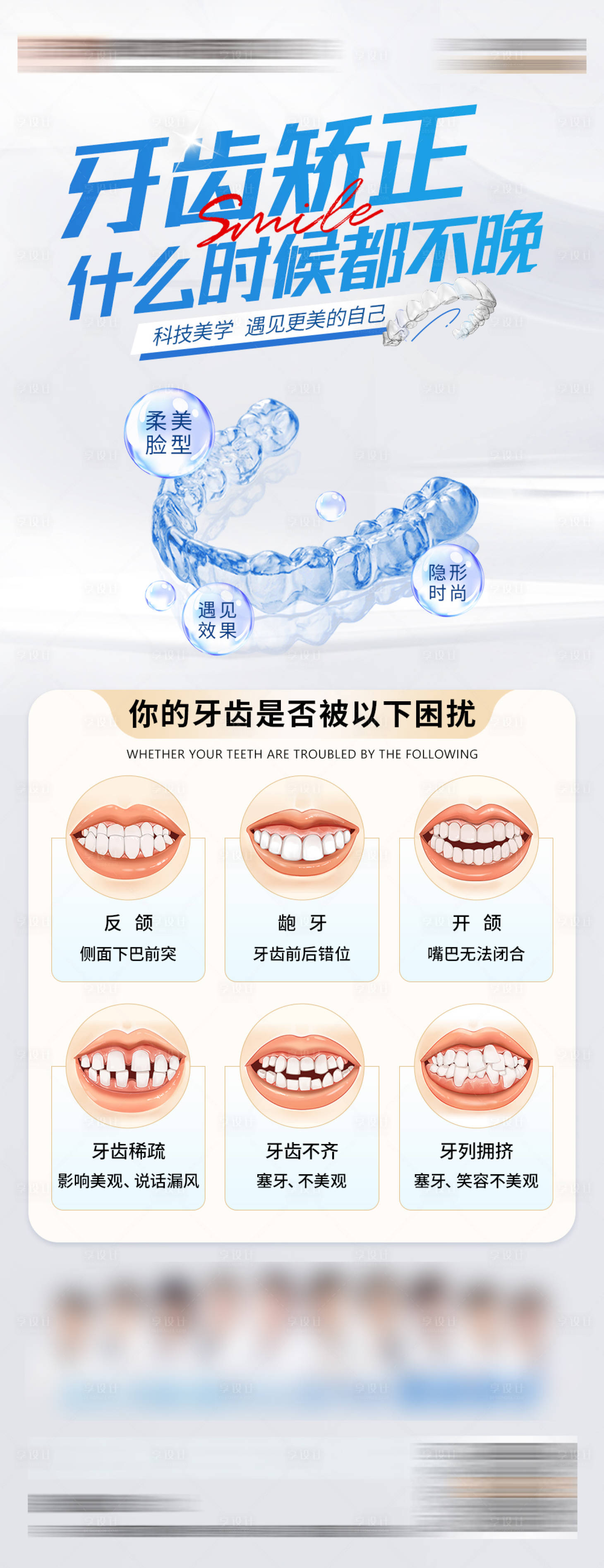 源文件下載【享設(shè)計(jì)】搜索編號(hào)：40180024750796460【牙齒矯正海報(bào)】