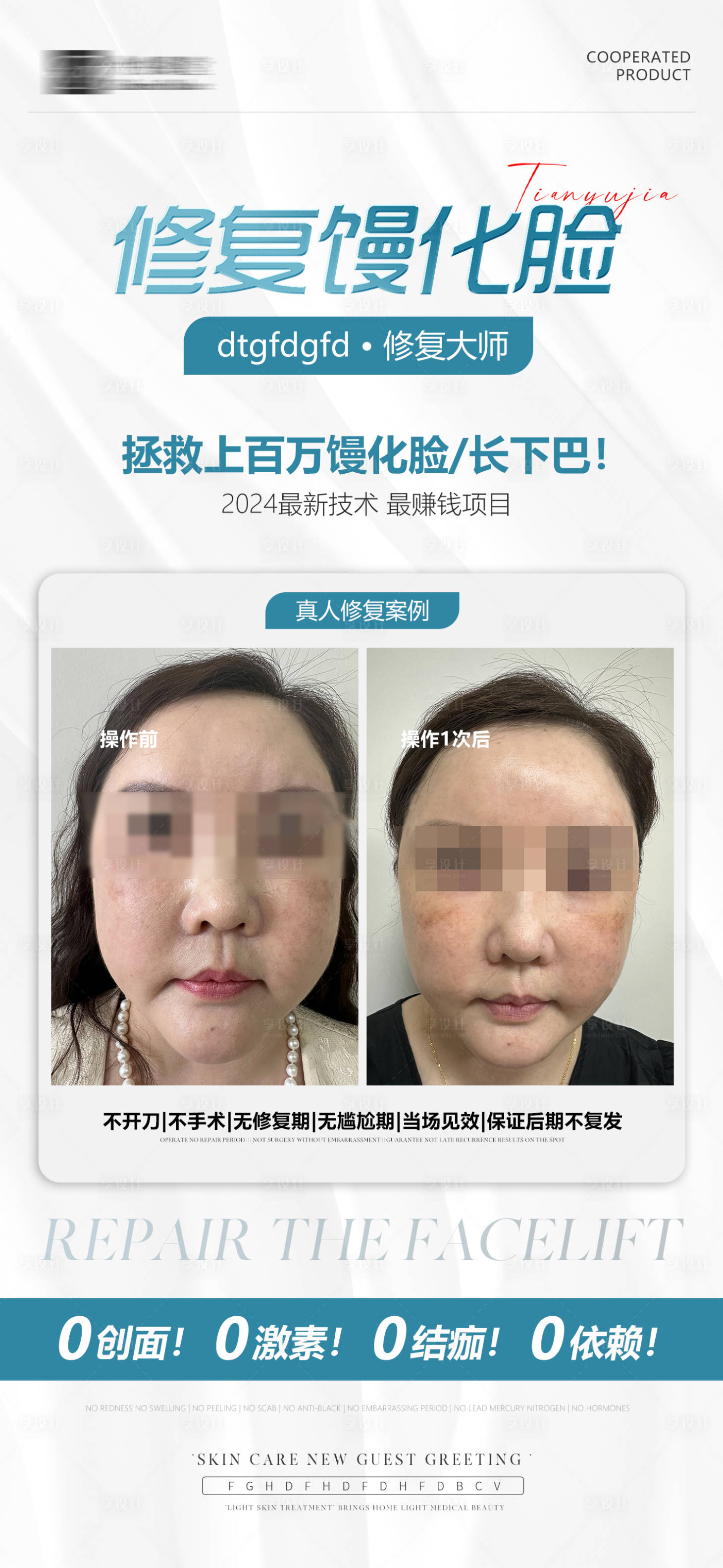 源文件下载【享设计】搜索编号：47490024399679067【修复馒化脸案例海报】