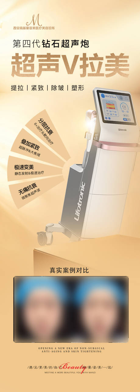 超声v拉美