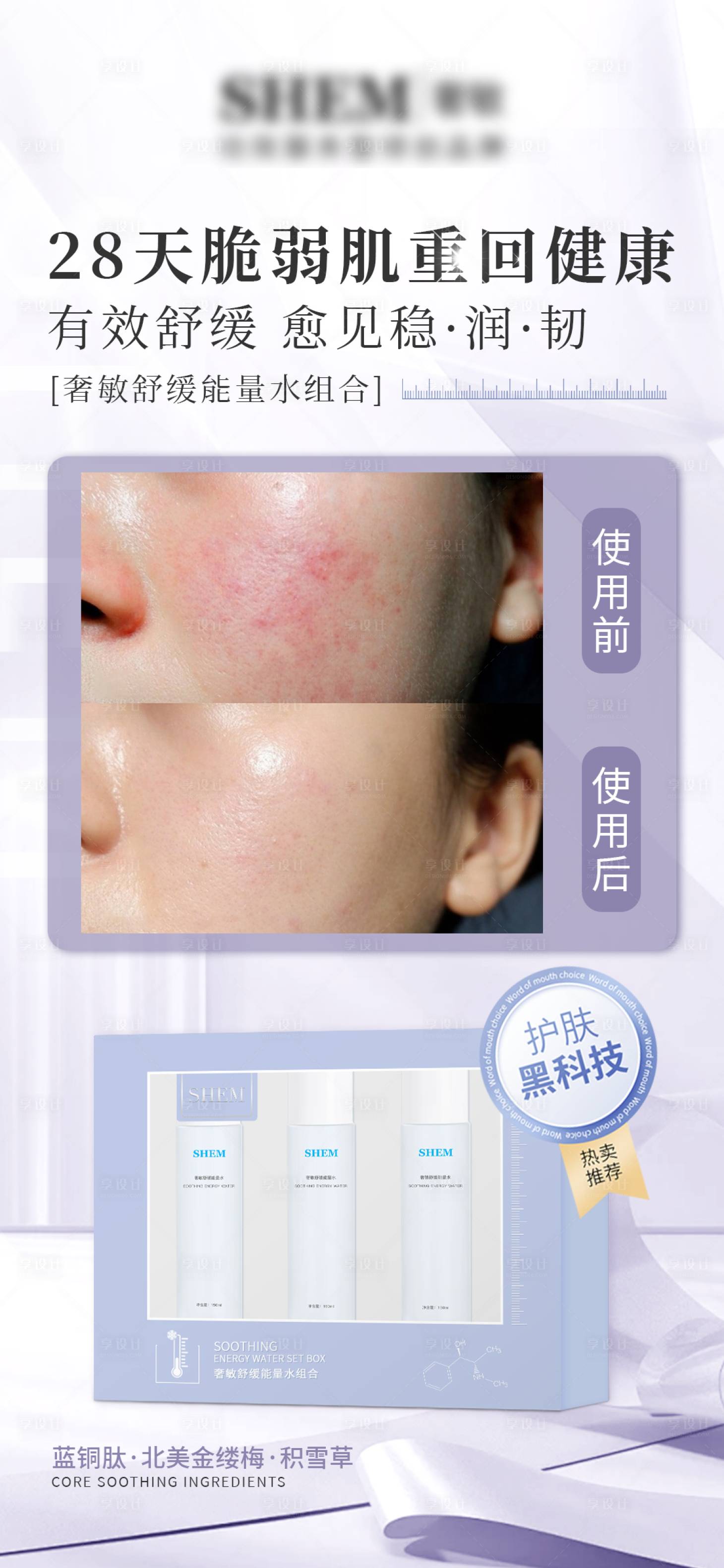 源文件下载【享设计】搜索编号：24260024670555736【医美产品案例海报】