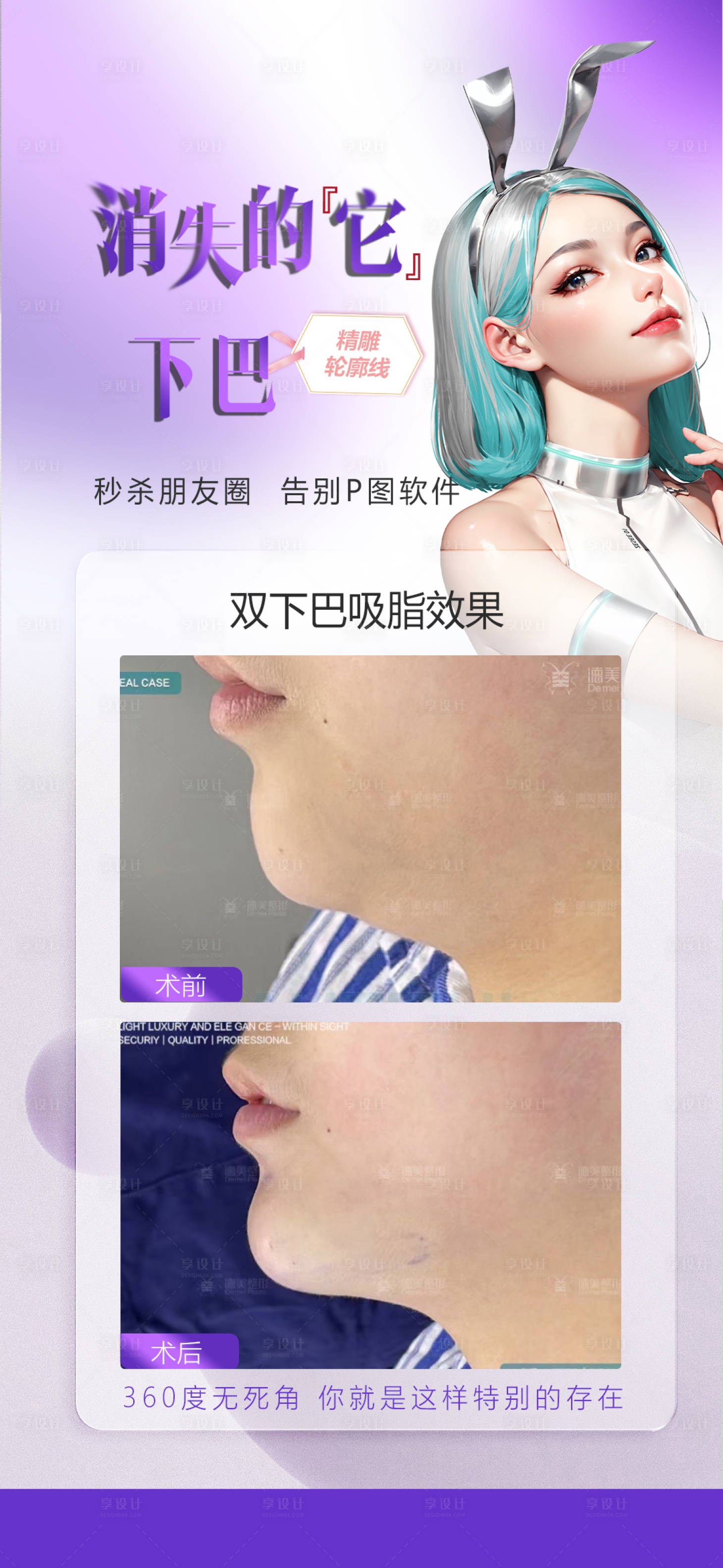 源文件下載【享設計】搜索編號：17650024853006608【雙下巴吸脂】
