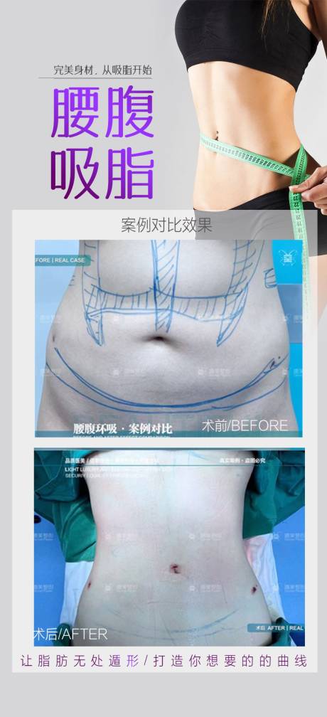 源文件下载【腰腹吸脂案例海报】编号：45520024789908555