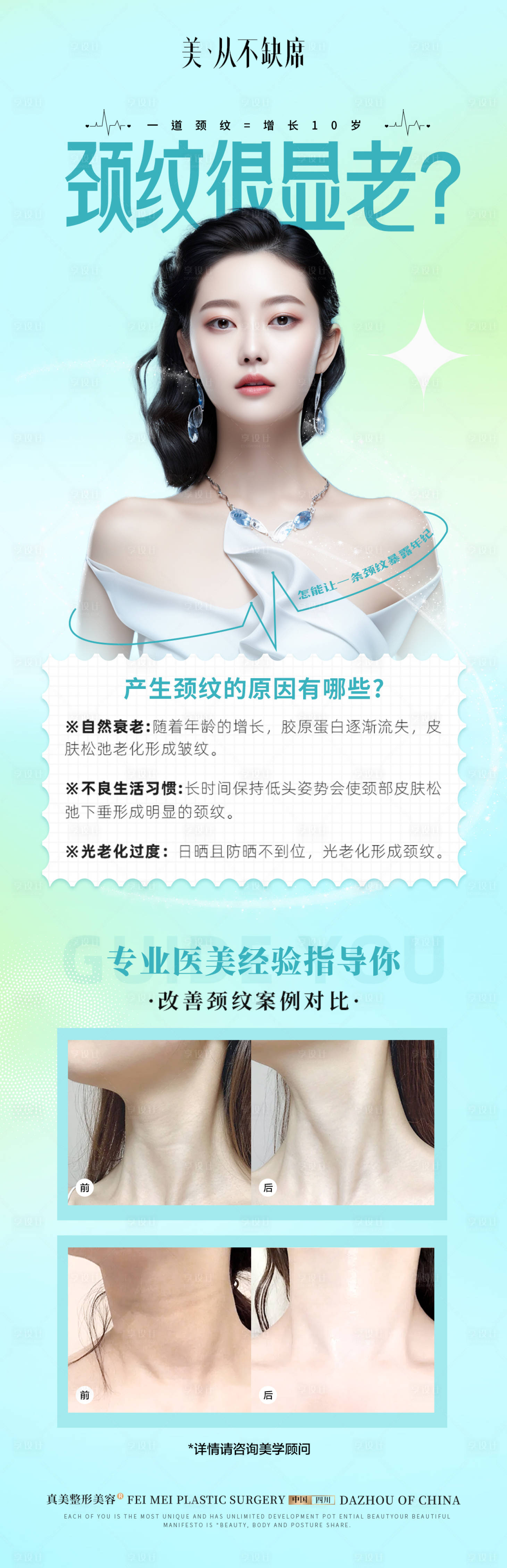源文件下載【享設(shè)計(jì)】搜索編號(hào)：41780024265486005【醫(yī)美祛頸紋案例海報(bào)】