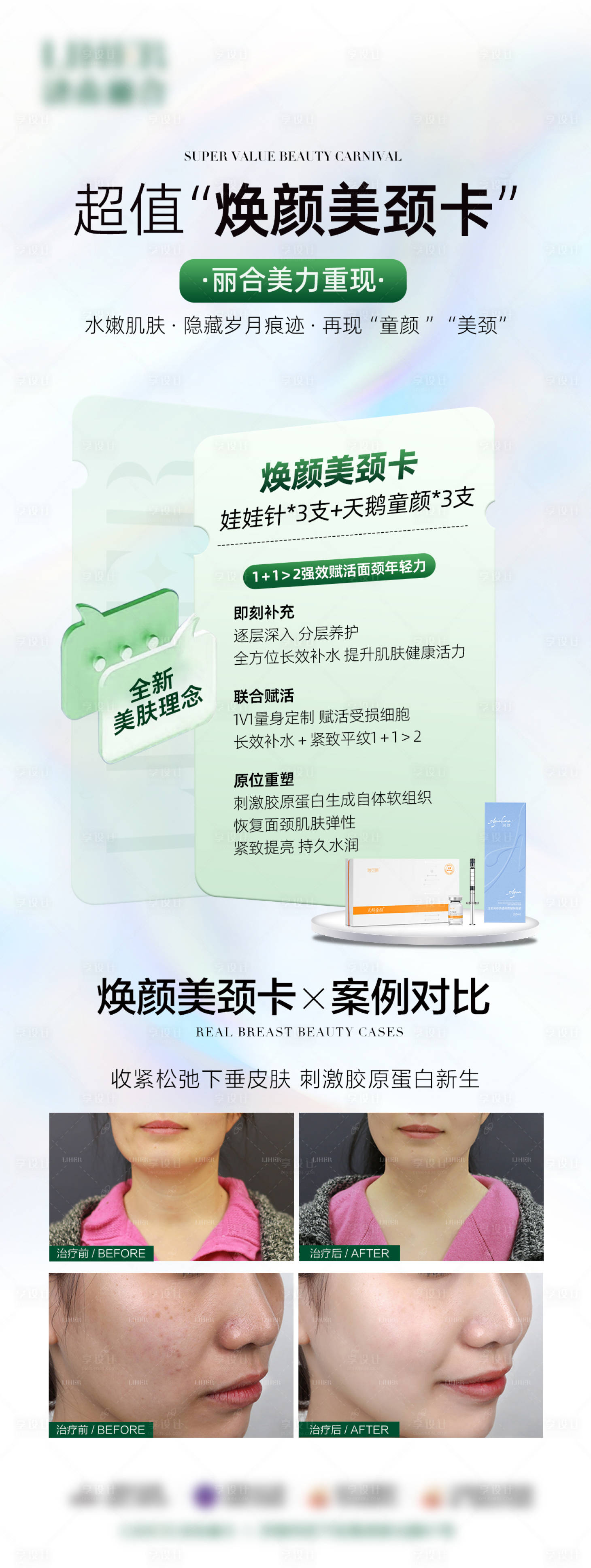 源文件下载【享设计】搜索编号：72680024586907490【医美项目案例海报】