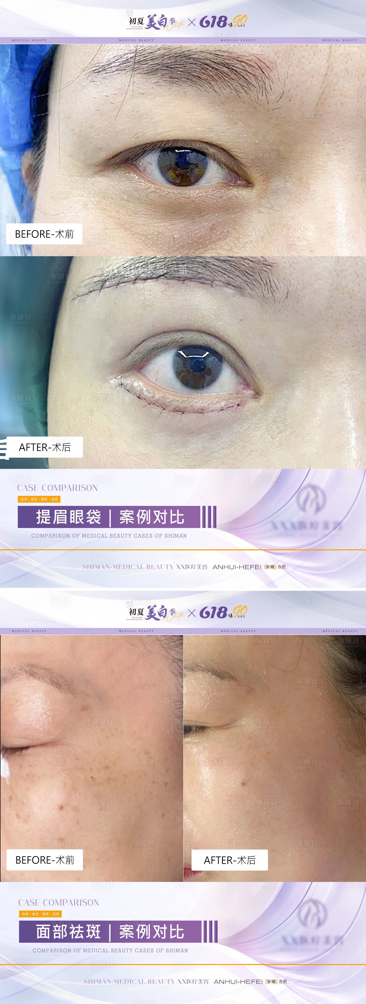 源文件下載【享設(shè)計(jì)】搜索編號(hào)：29150024530078321【醫(yī)美項(xiàng)目案例對(duì)比模板海報(bào)】