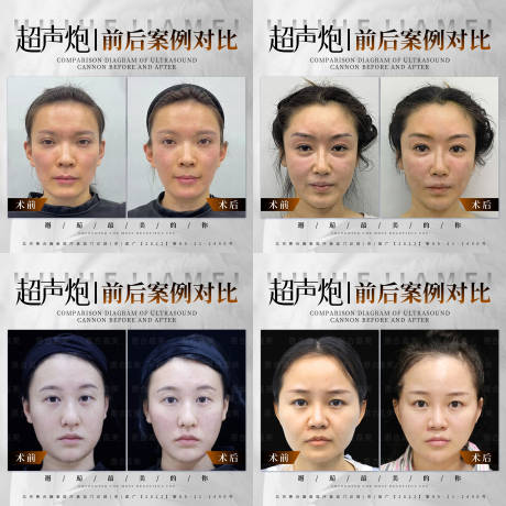 源文件下載【享設(shè)計(jì)】搜索編號(hào)：77150024788021233【醫(yī)美 】