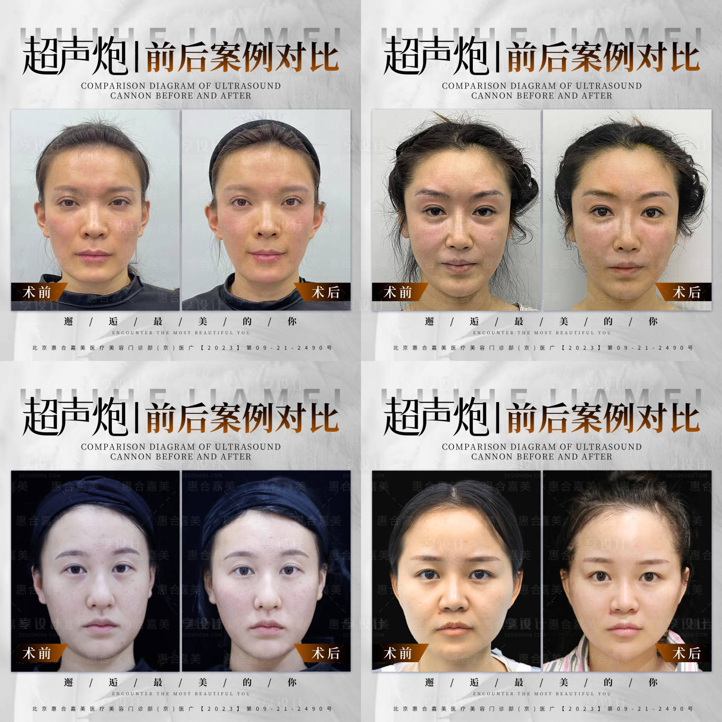源文件下載【享設計】搜索編號：77150024788021233【醫美 】
