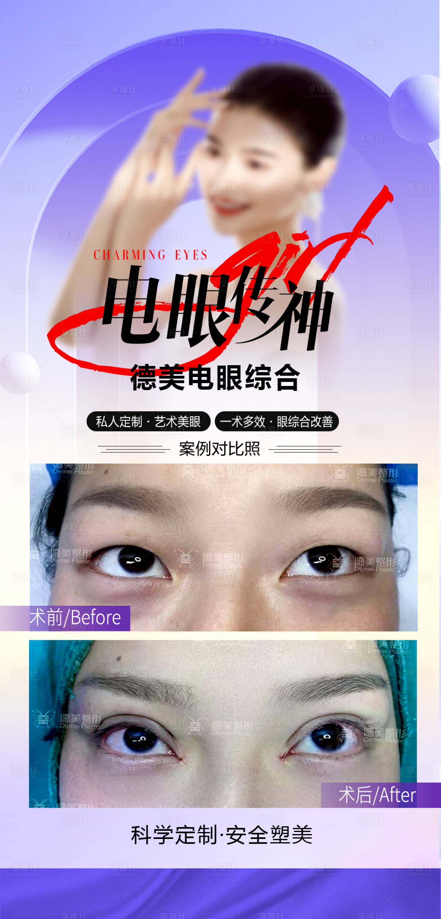 源文件下載【眼綜合案例海報】編號：23870024813774790