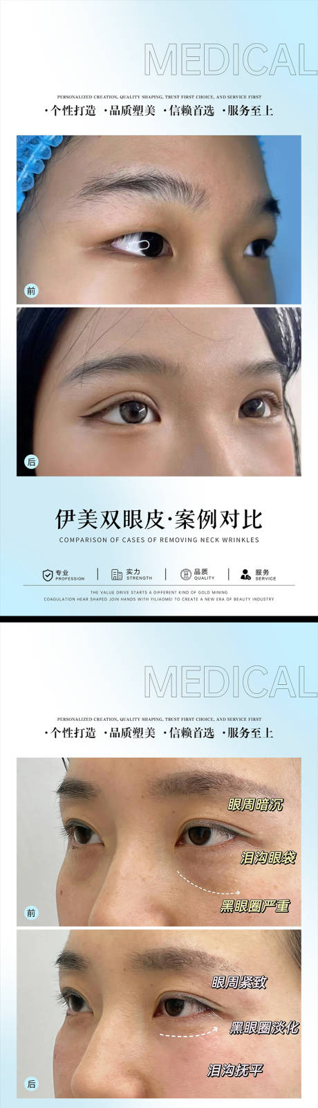 源文件下载【医美案例对比海报】编号：65490024801267596