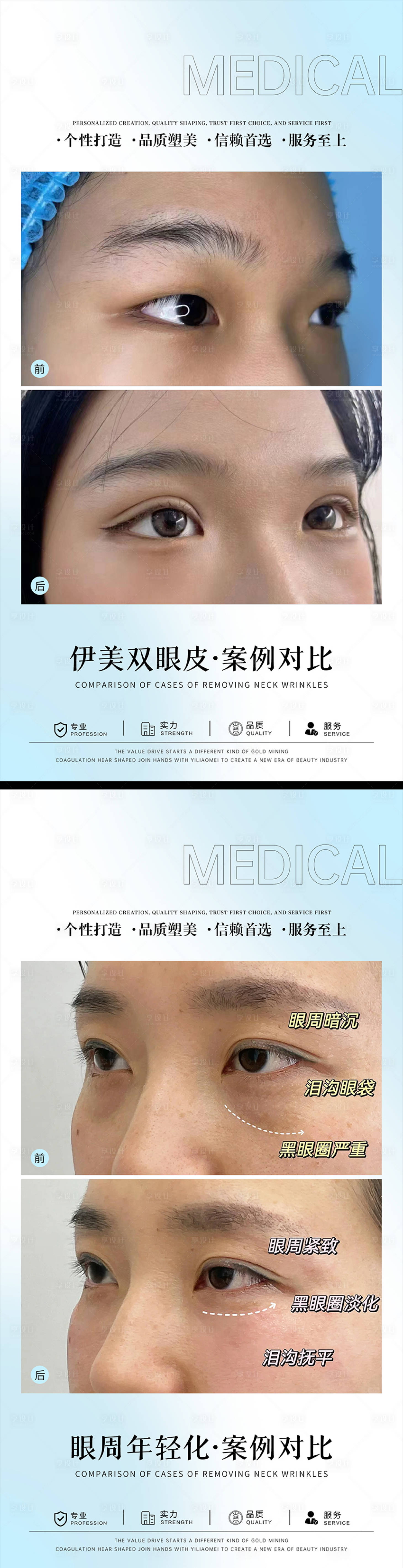 源文件下载【享设计】搜索编号：65490024801267596【医美案例对比海报】