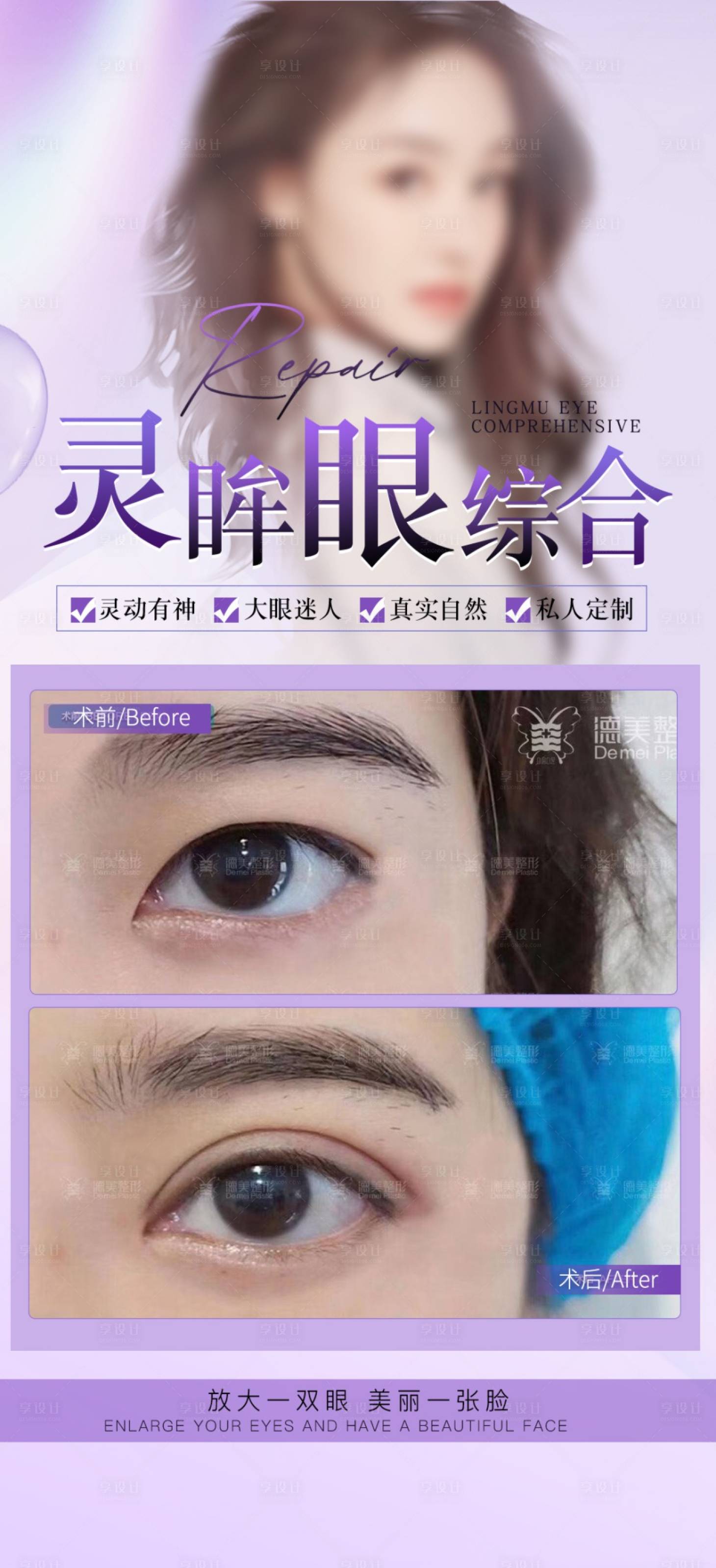 源文件下載【享設計】搜索編號：67000024559006002【眼綜合案例海報】