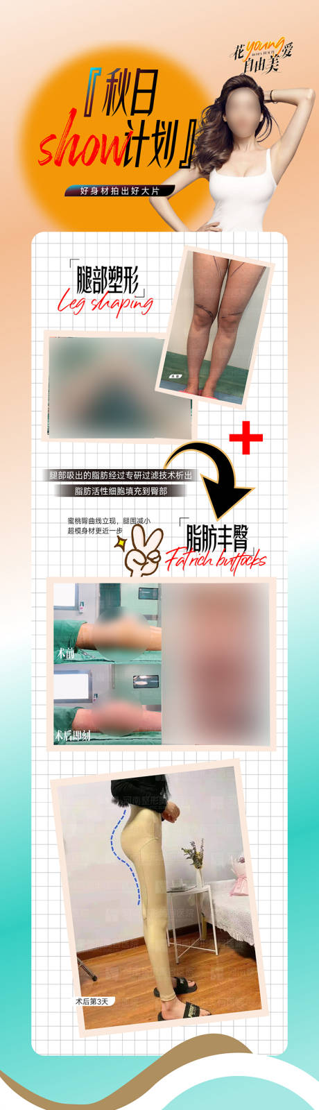 源文件下载【脂肪整形  】编号：51030019412412255