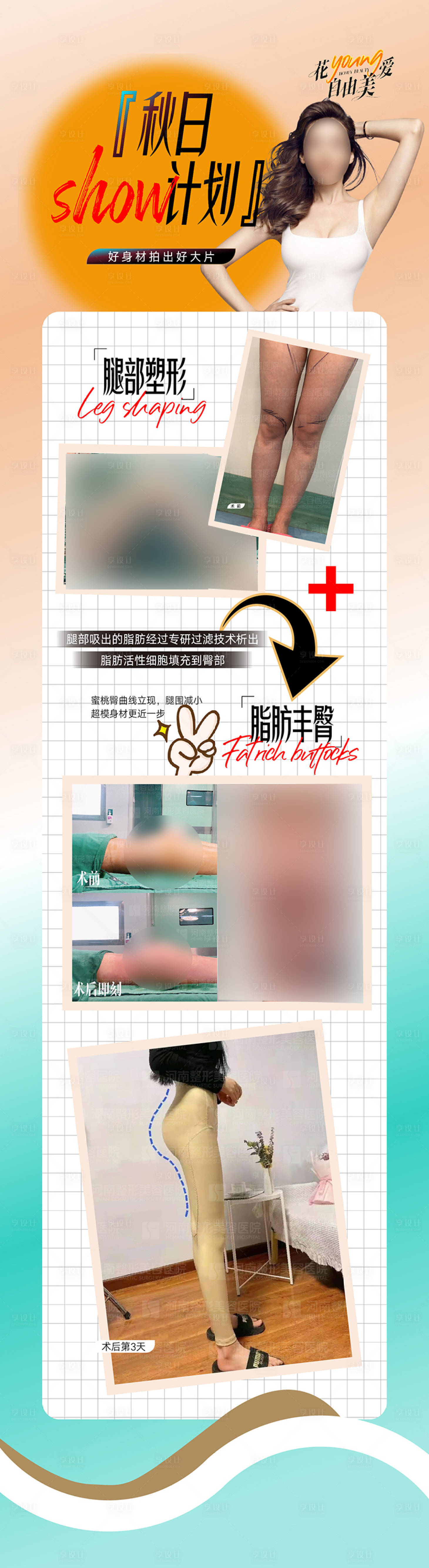 源文件下载【脂肪整形  】编号：51030019412412255