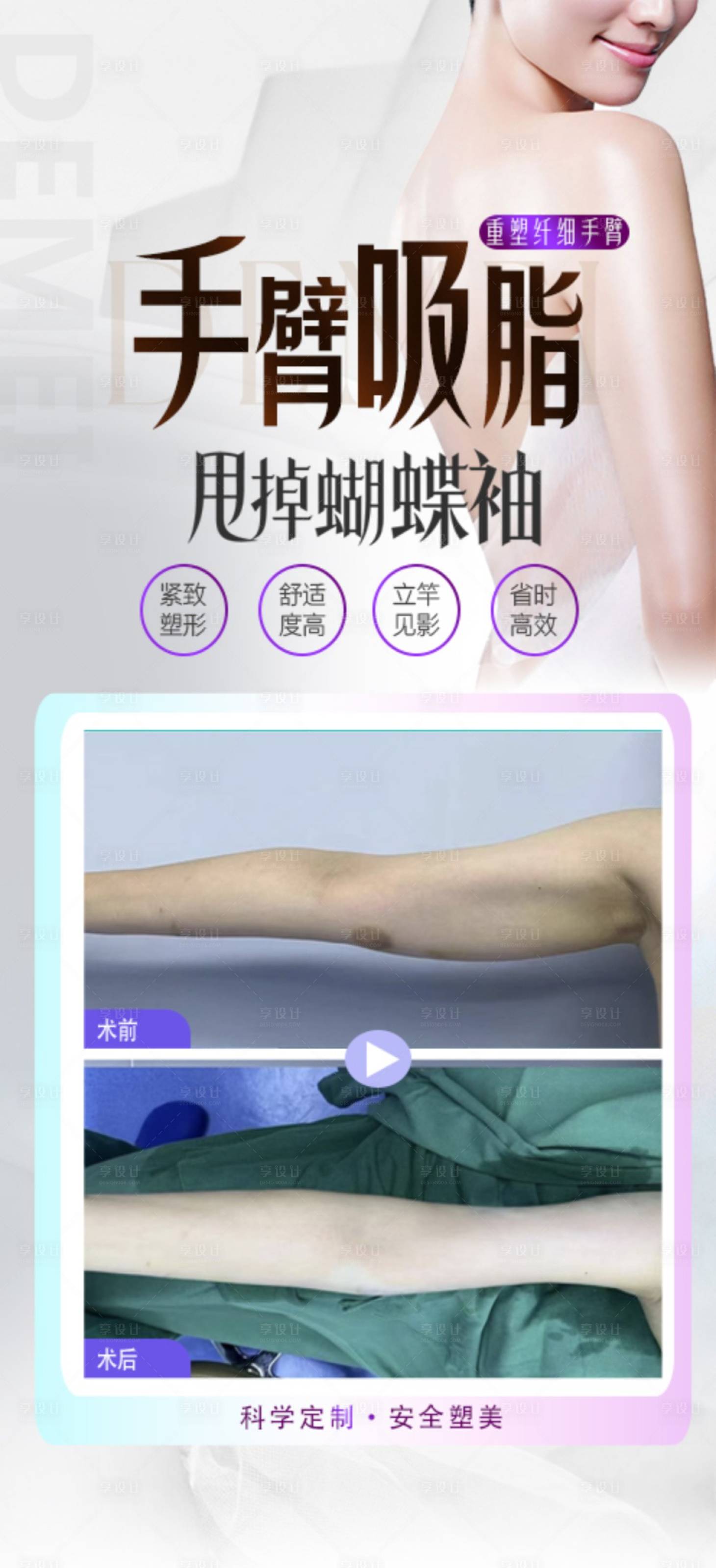源文件下载【享设计】搜索编号：87550025182713218【手臂吸脂案例海报】