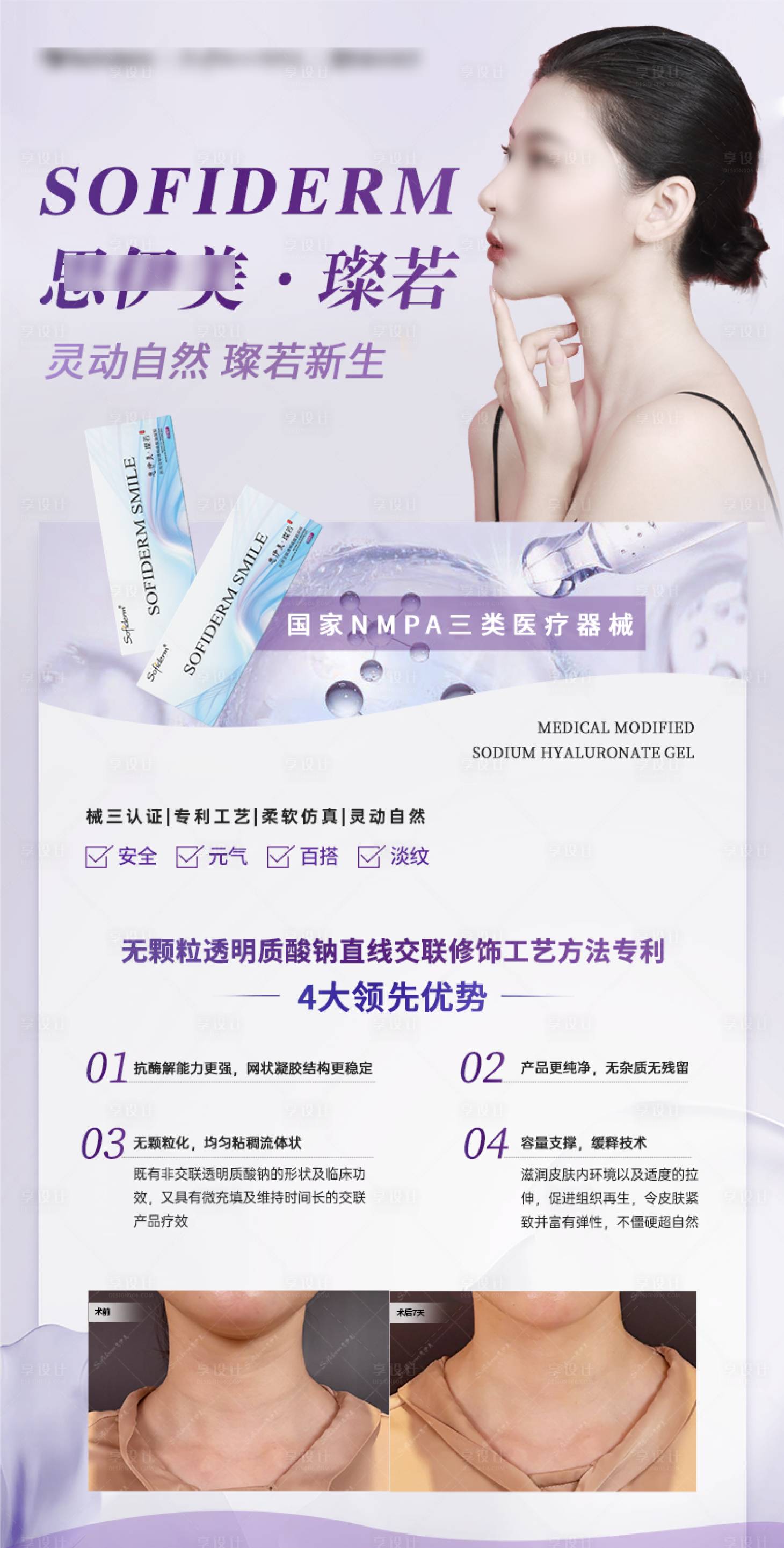 源文件下载【享设计】搜索编号：90790024675681161【医美玻尿酸案例海报】