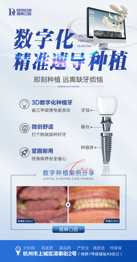 源文件下载【口腔数字化种植牙】编号：79540024891103152