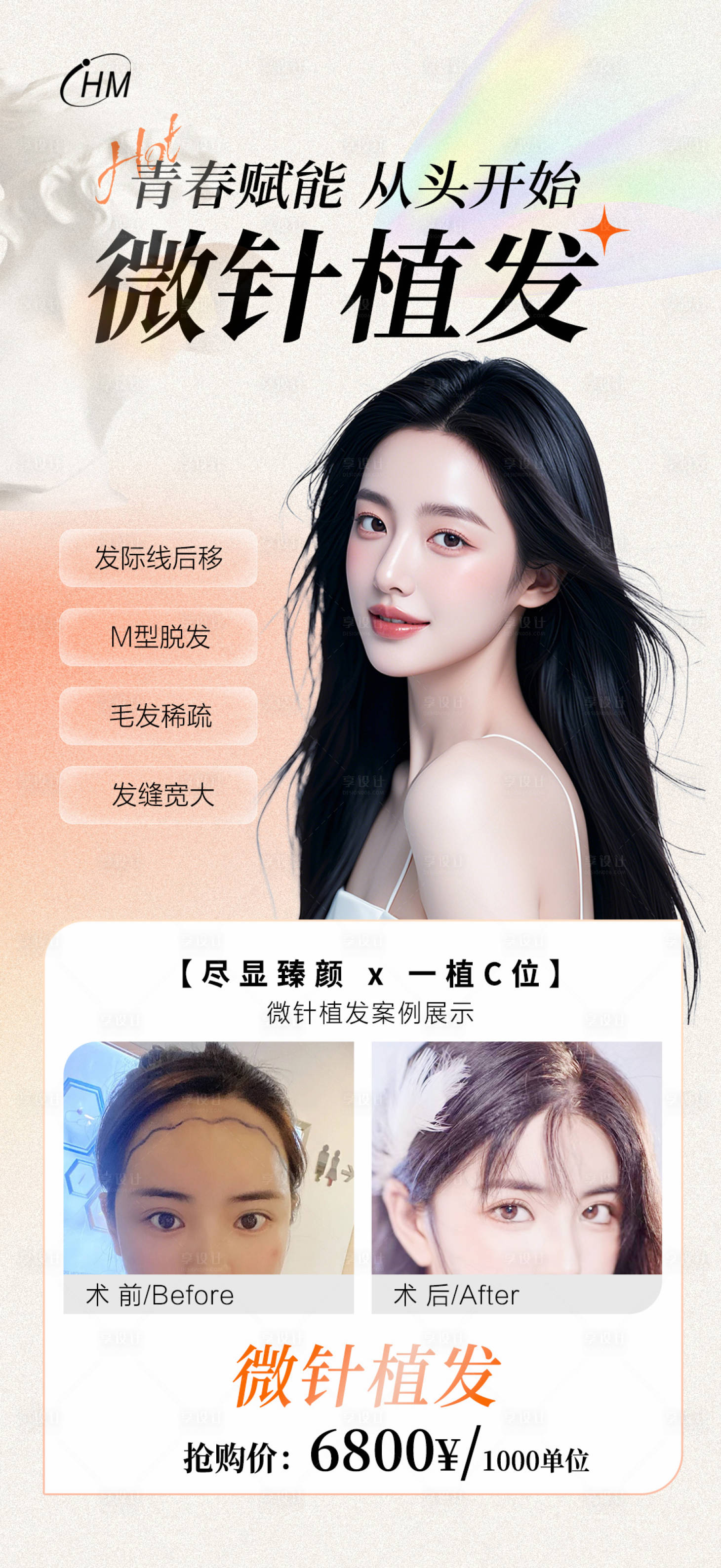 源文件下载【医美微针植发海报】编号：24330025431521750