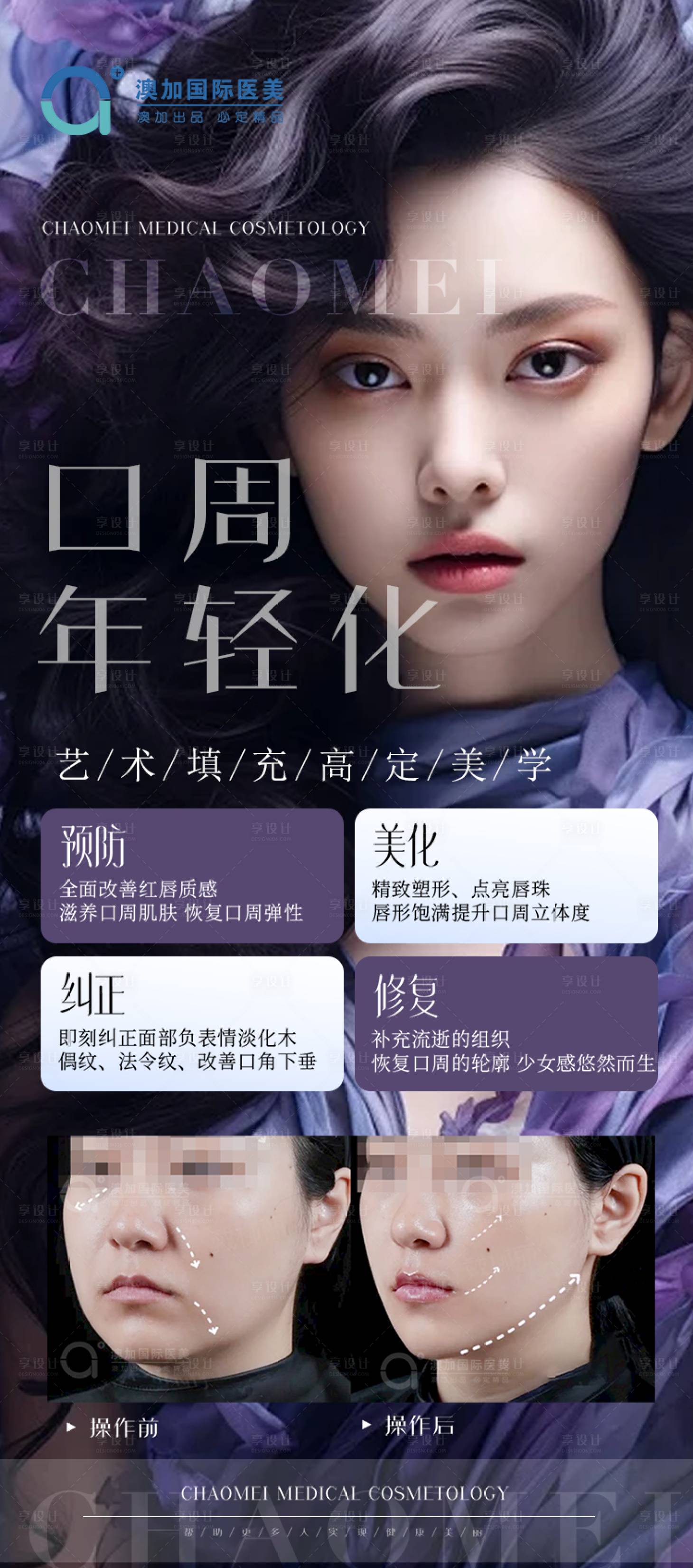 源文件下载【医美案例】编号：58180025092006276