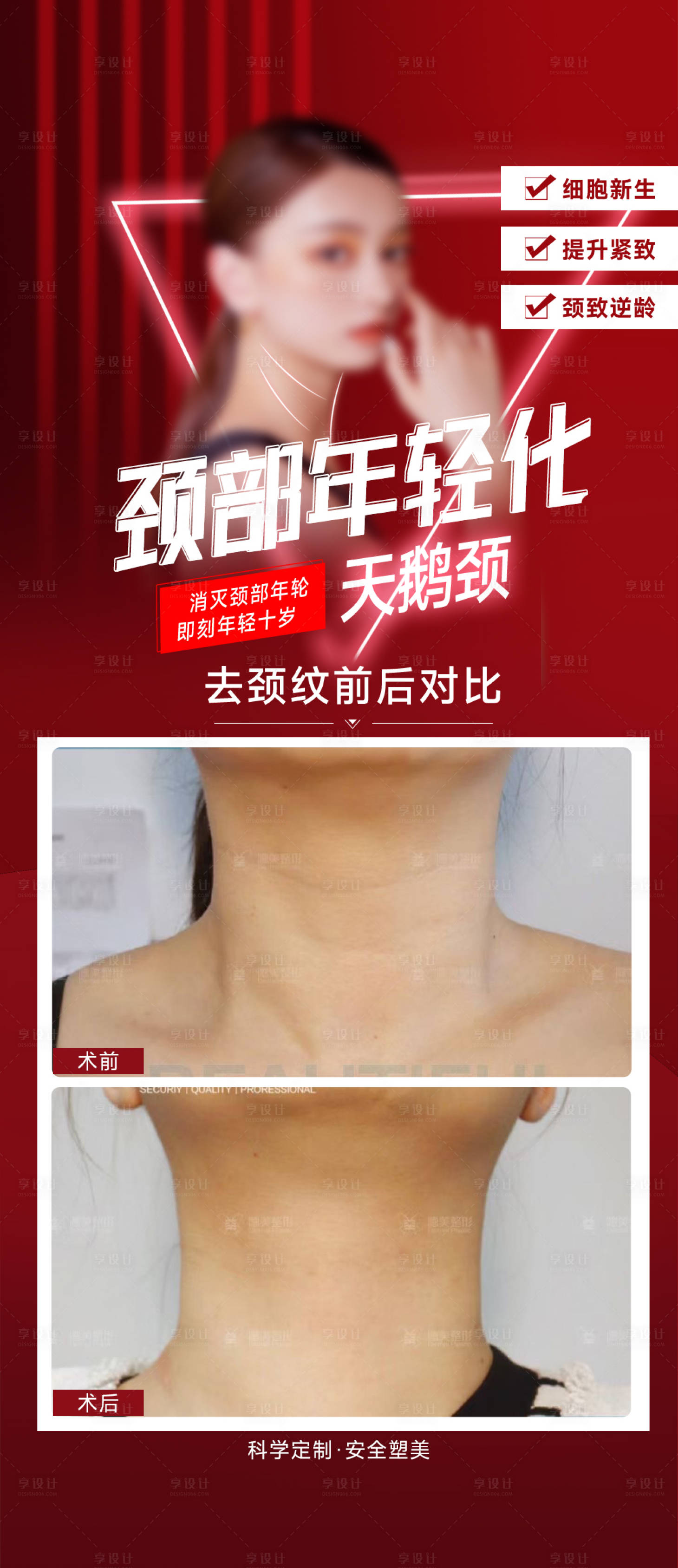 源文件下载【去颈纹案例】编号：46540024890622502