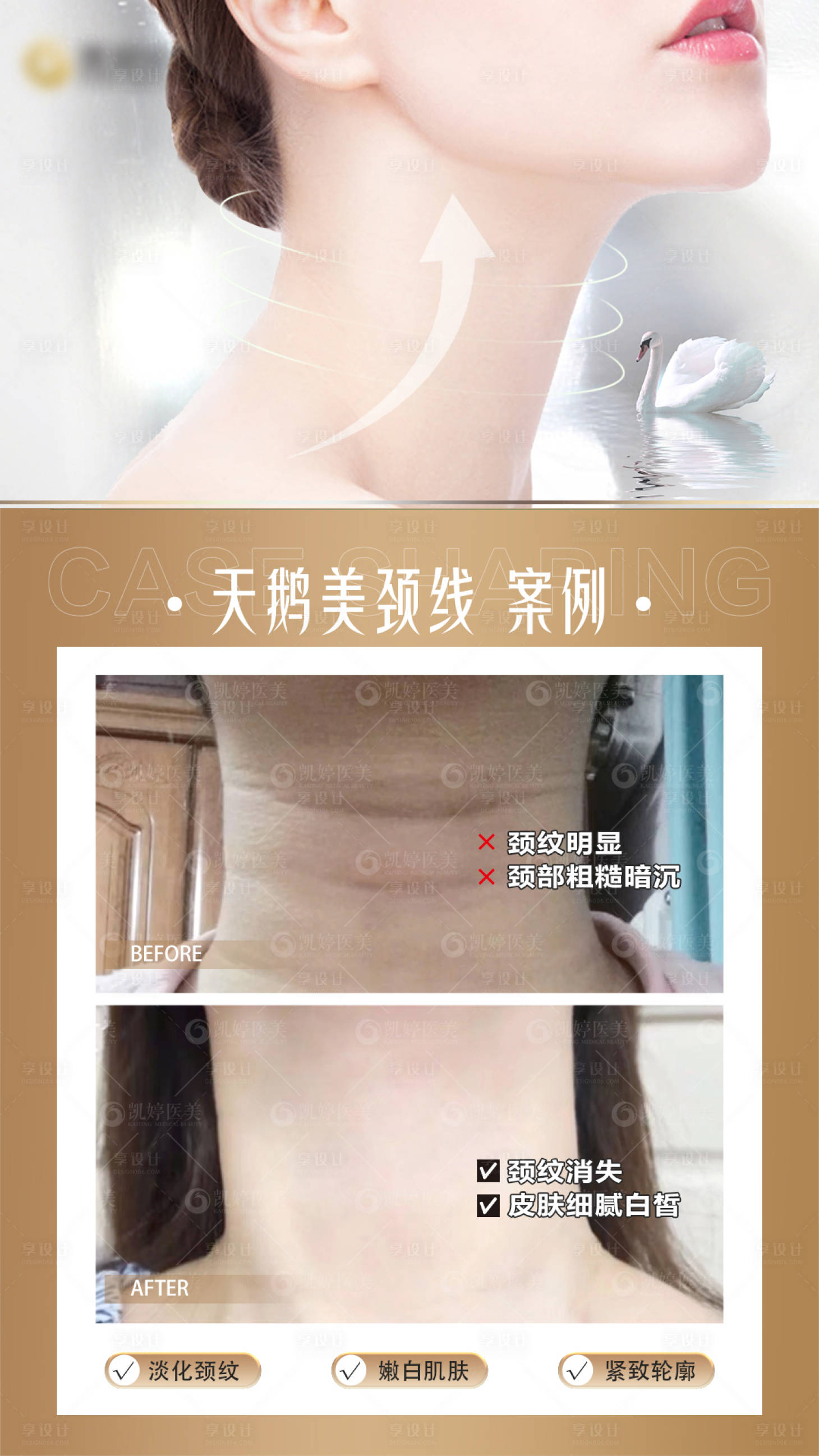 源文件下载【享设计】搜索编号：43190025032282225【医美颈部对比图】