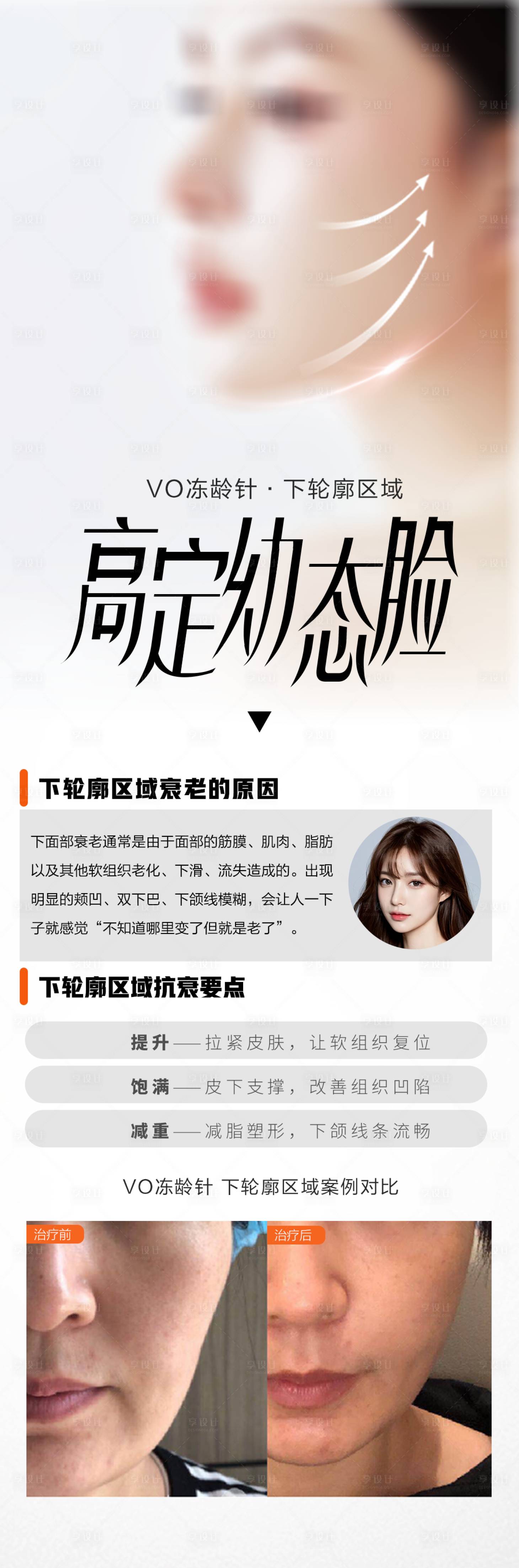 源文件下载【享设计】搜索编号：35810025426073127【医美抗衰项目海报】