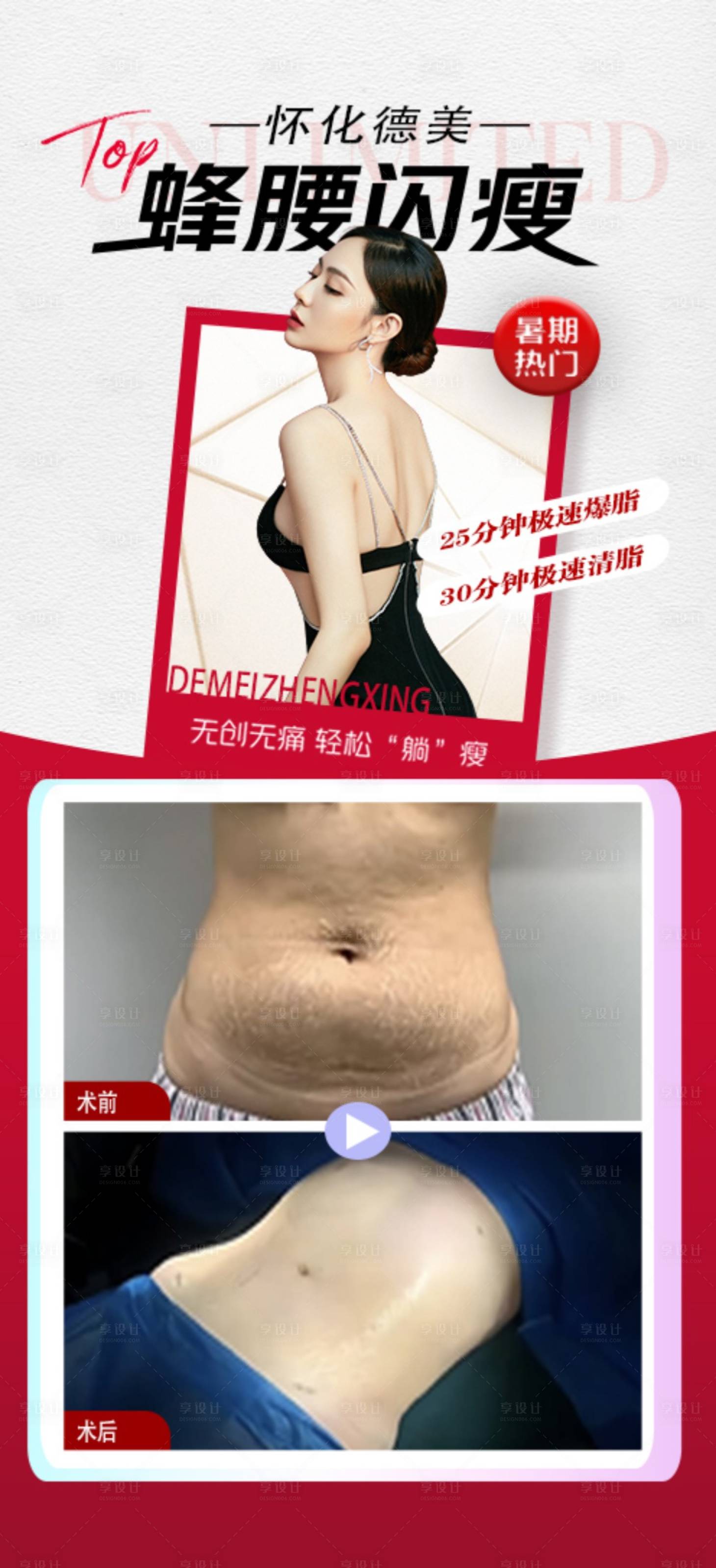 源文件下載【享設計】搜索編號：63220025196321071【腰腹吸脂】