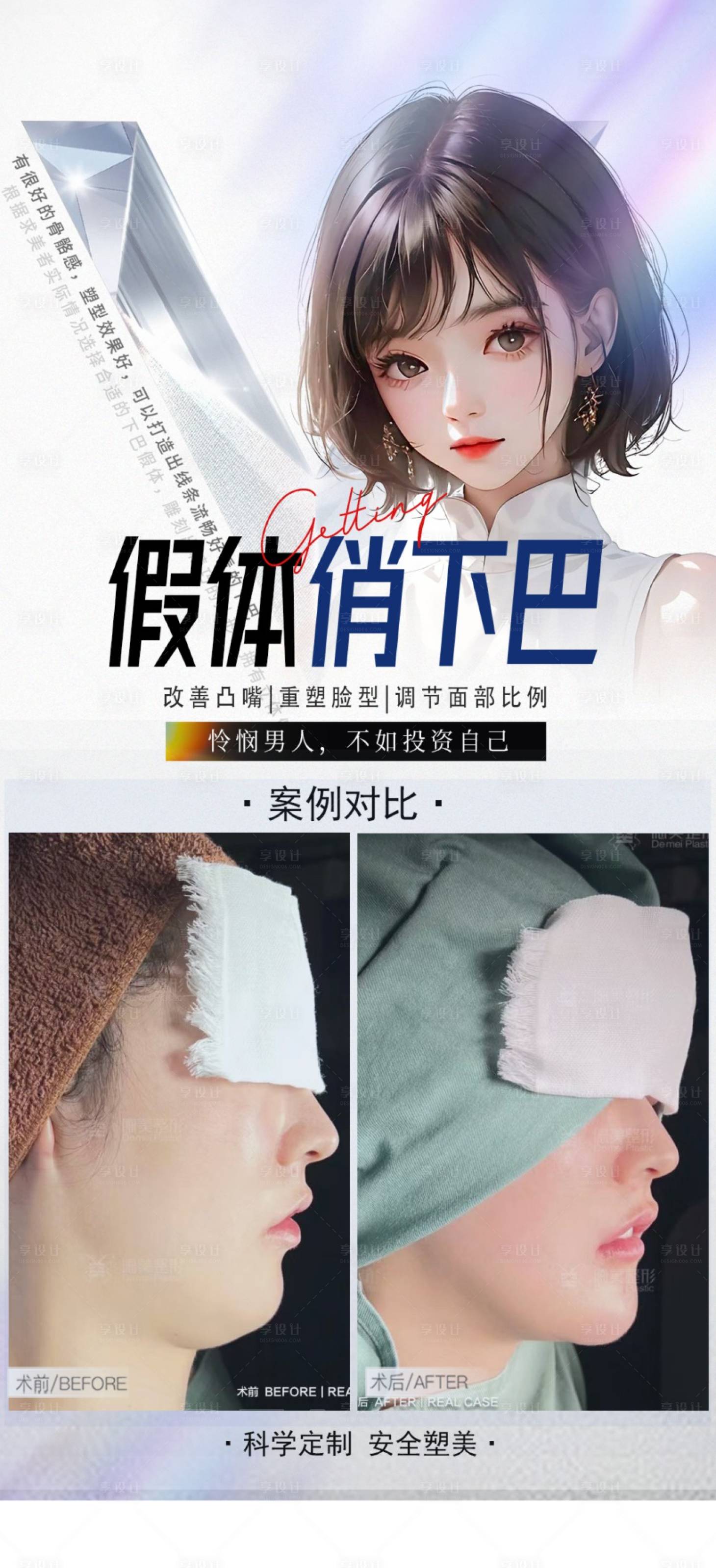 源文件下載【享設(shè)計(jì)】搜索編號(hào)：63370024943491878【假體下巴整形宣傳海報(bào)】