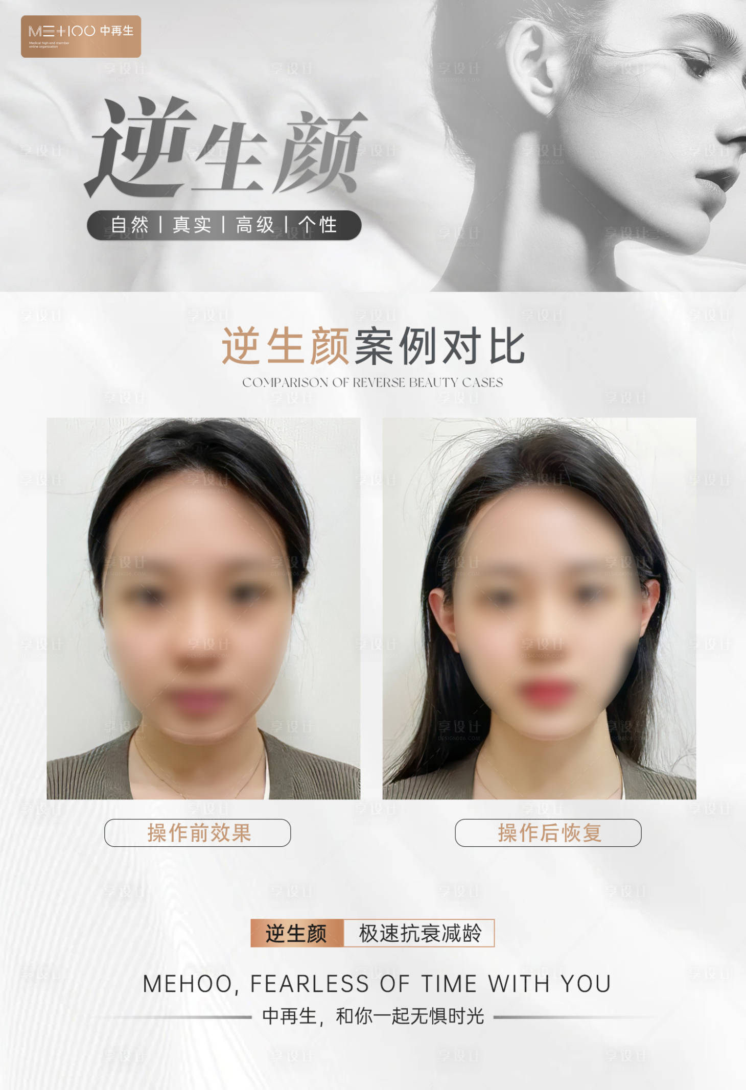 源文件下载【享设计】搜索编号：87890025149852054【医美案例高级感】