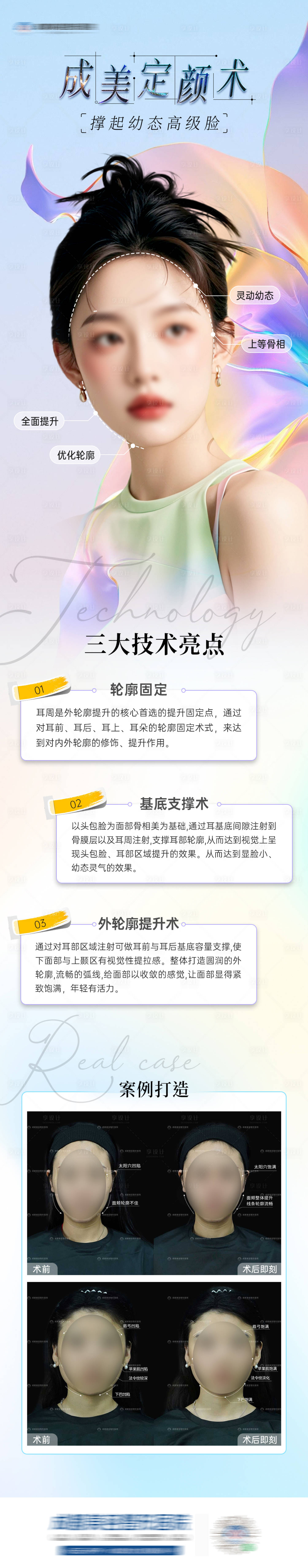 源文件下载【享设计】搜索编号：81900025277522913【医美轮廓固定案例海报】