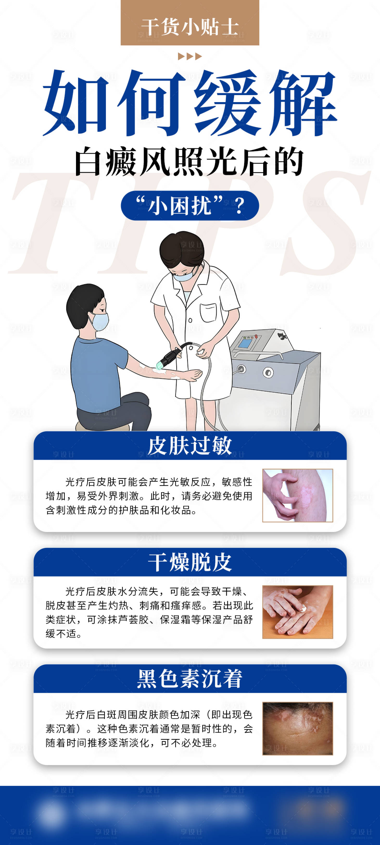 源文件下载【享设计】搜索编号：26770025031693008【白癜风照光后的小困扰科普海报】