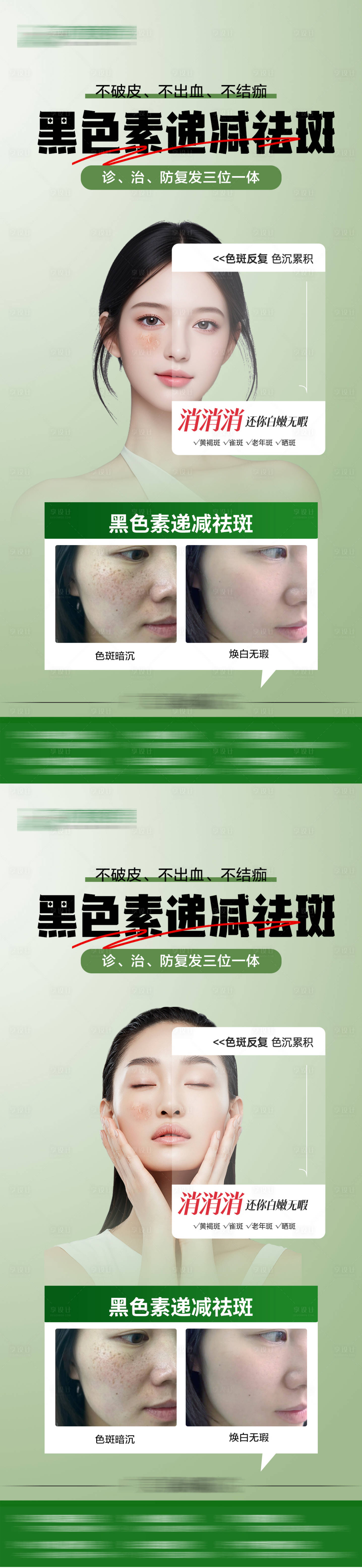 源文件下載【享設(shè)計】搜索編號：27200025113696129【醫(yī)美祛斑案例海報】