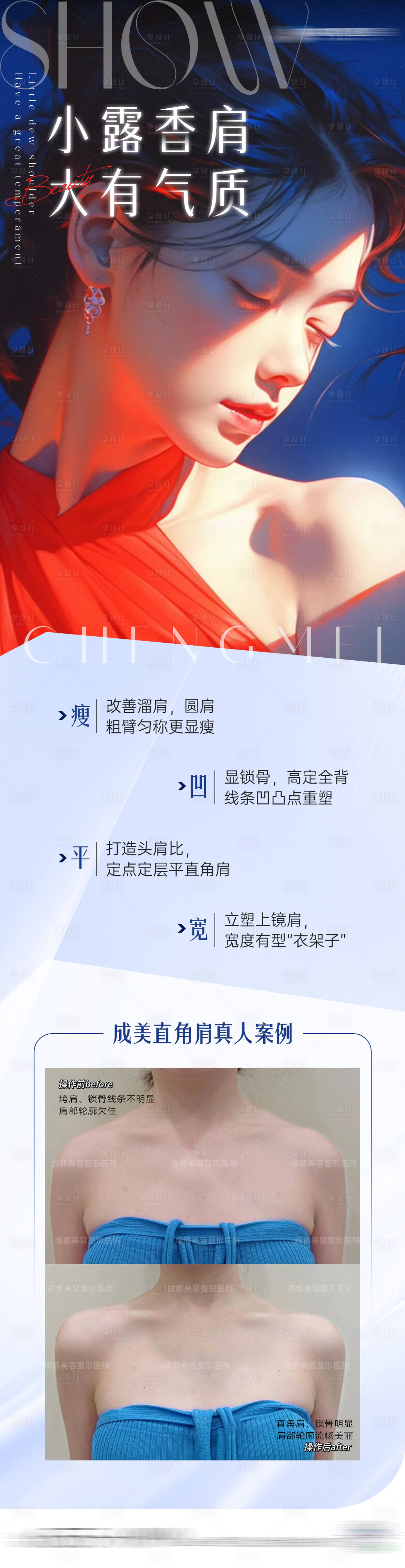 源文件下载【医美直角肩案例海报】编号：21430025116027854