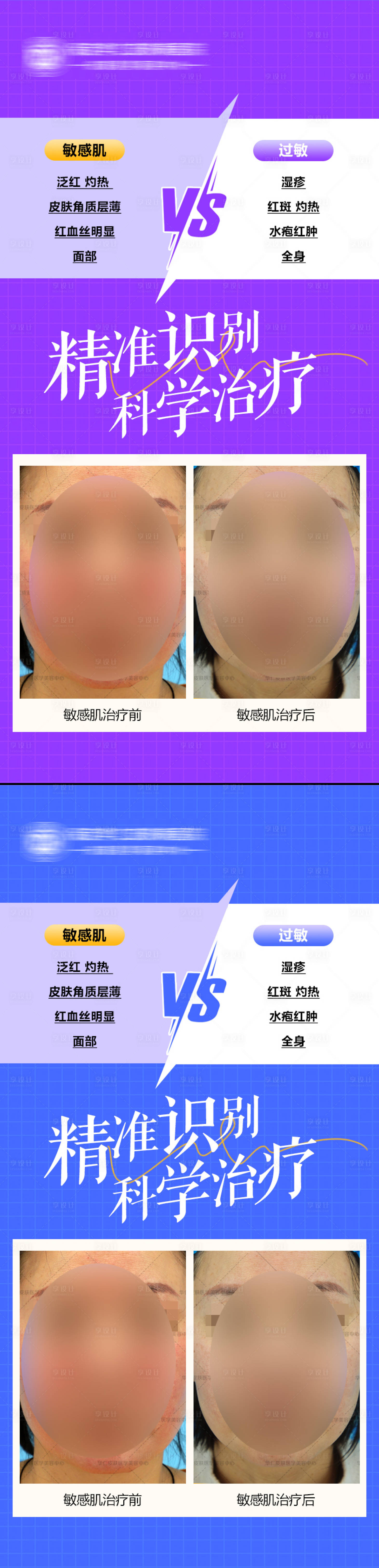 源文件下载【享设计】搜索编号：80770025315436969【医美护肤科普案例对比海报】