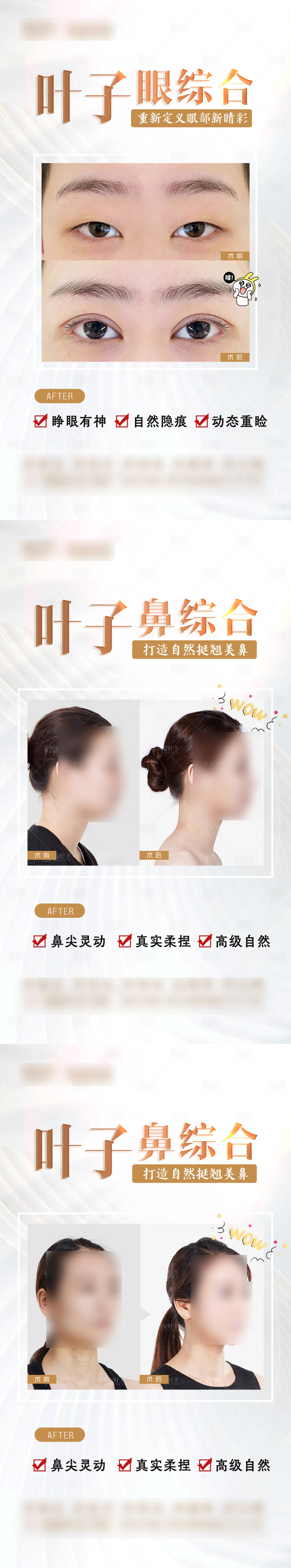 源文件下载【眼鼻案例海报】编号：82070025010742996