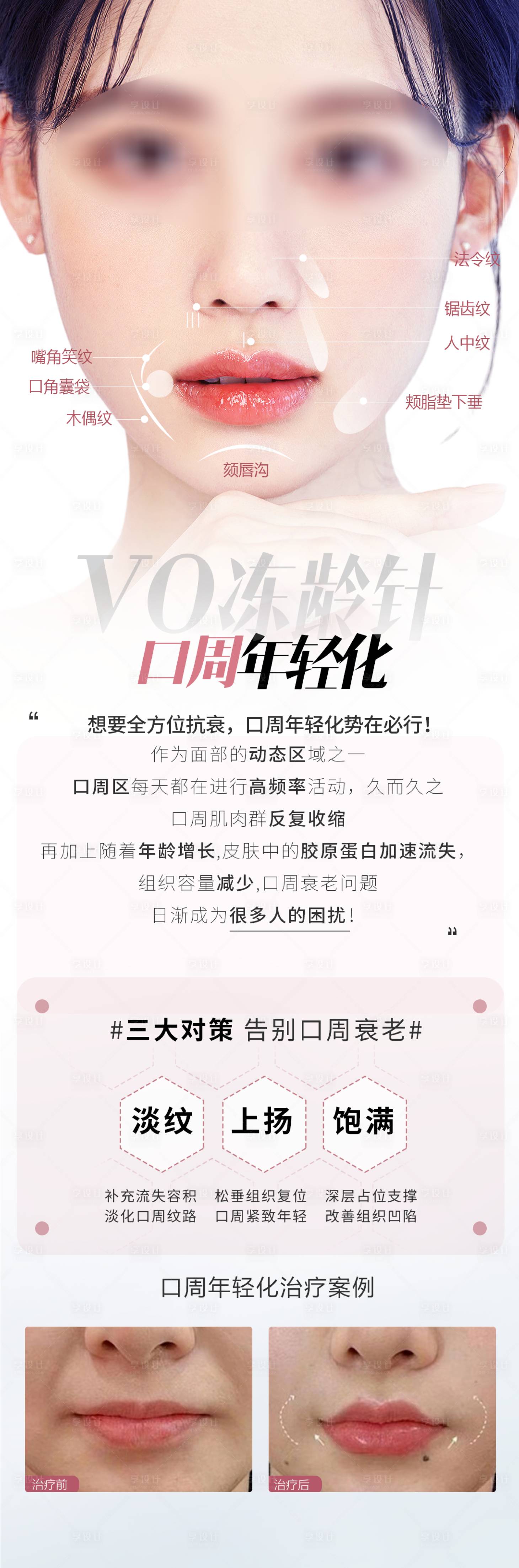 源文件下载【医美抗衰海报】编号：22810025426032201