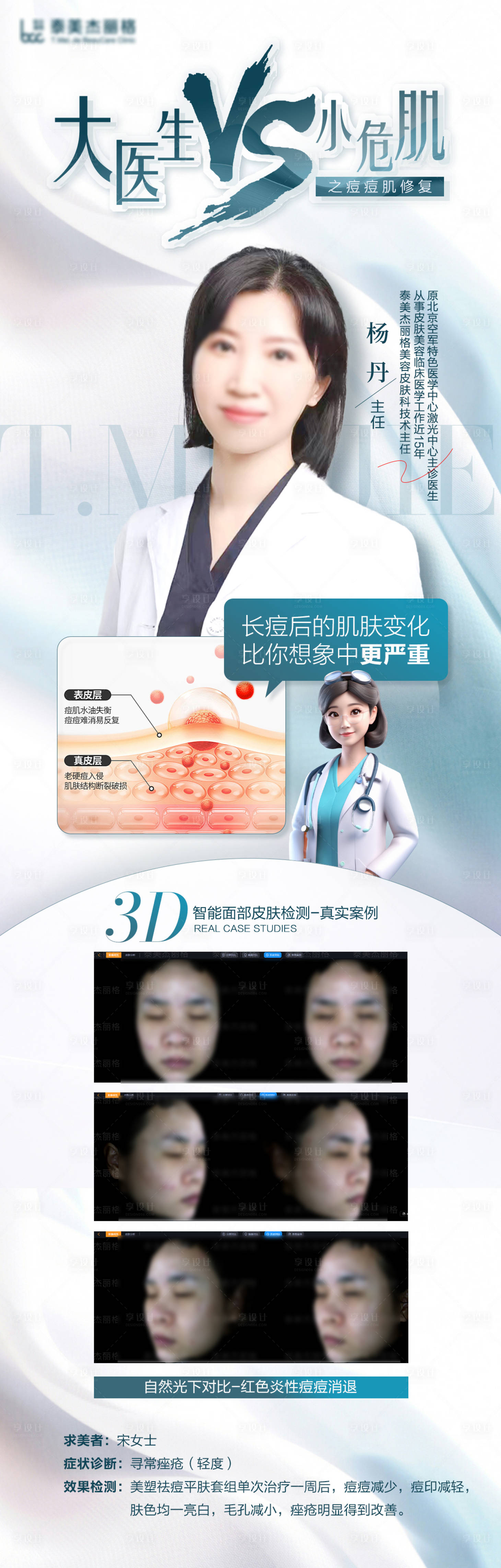 源文件下載【享設(shè)計】搜索編號：46570025040127990【醫(yī)美整形祛痘海報】