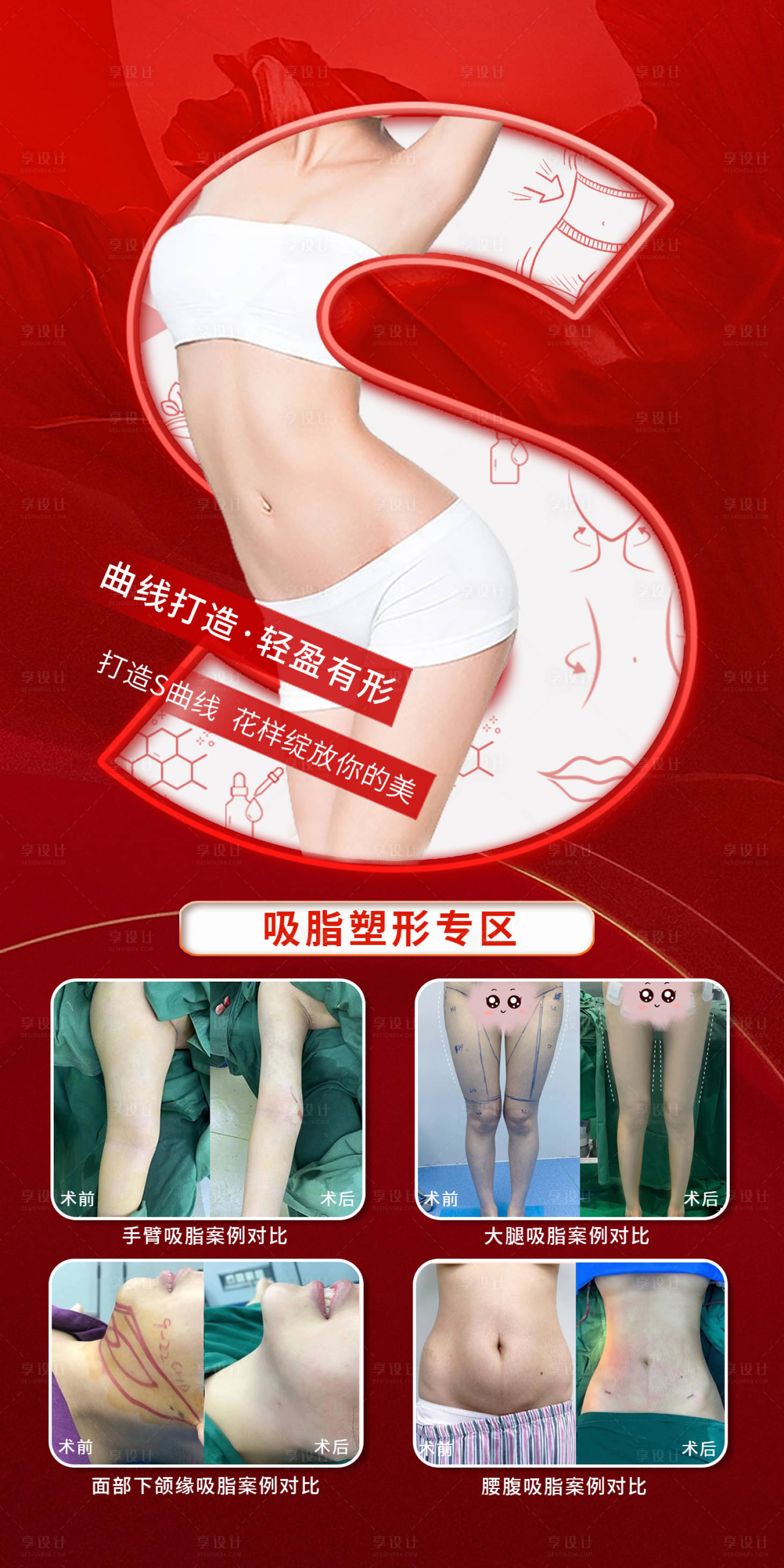 源文件下載【享設計】搜索編號：34350025041089349【醫美吸脂海報】
