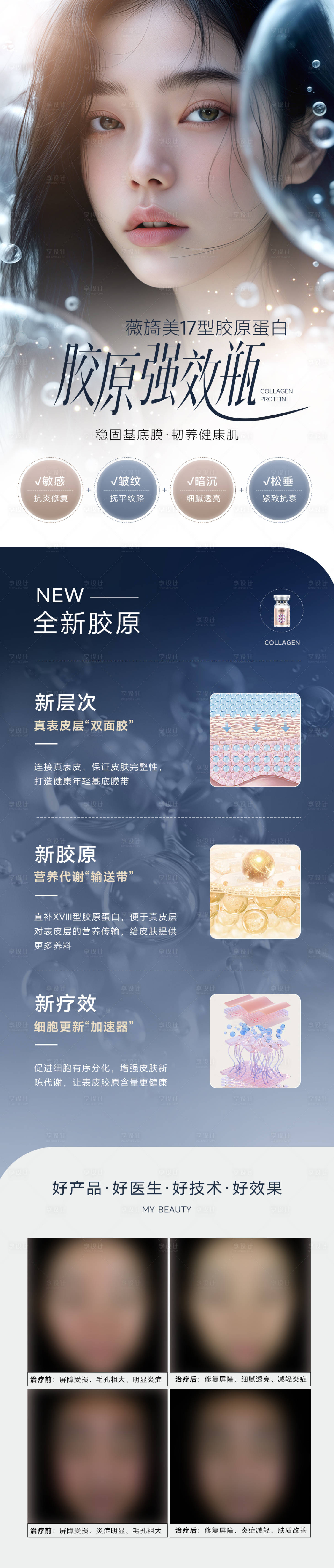 源文件下载【享设计】搜索编号：40130025152179573【医美新品宣传长图】