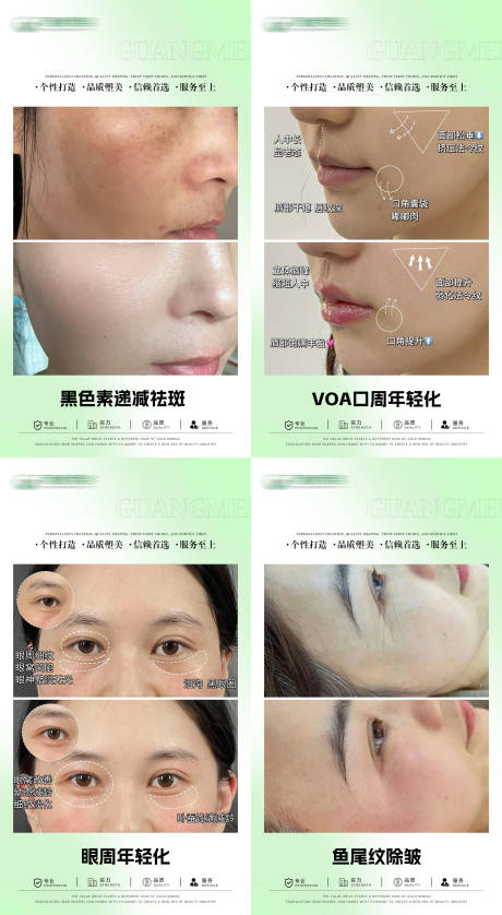 源文件下載【醫美案例對比海報】編號：62060025177957519