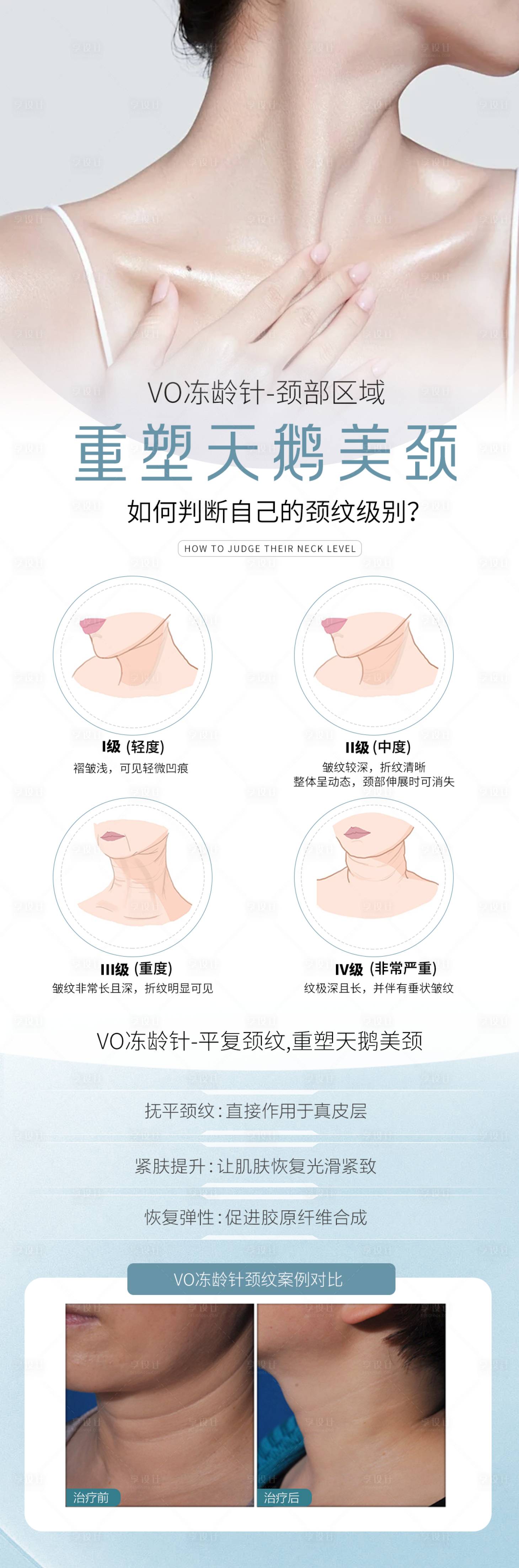 源文件下载【享设计】搜索编号：67880025425341284【医美抗衰天鹅颈颈部宣传海报】