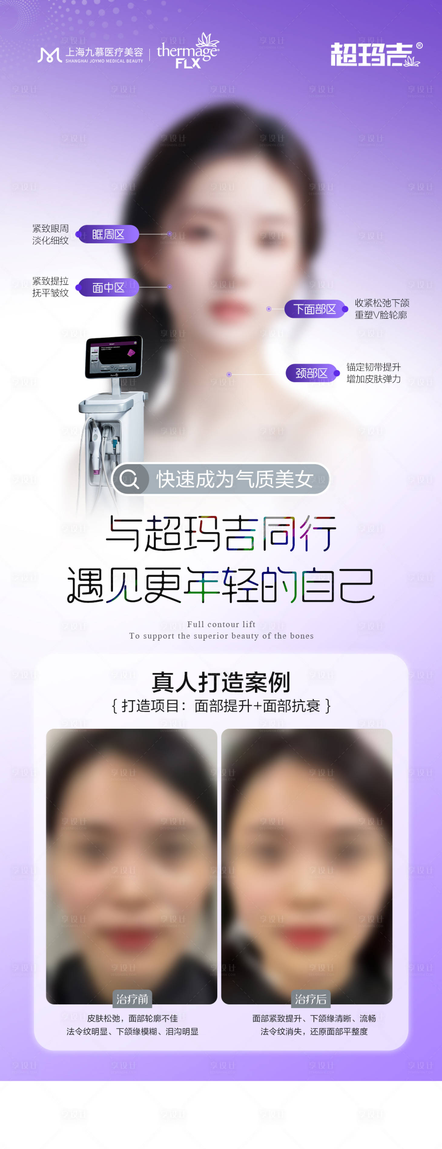 源文件下載【享設計】搜索編號：46610025244843247【醫(yī)美五代熱瑪吉案例對比海報】