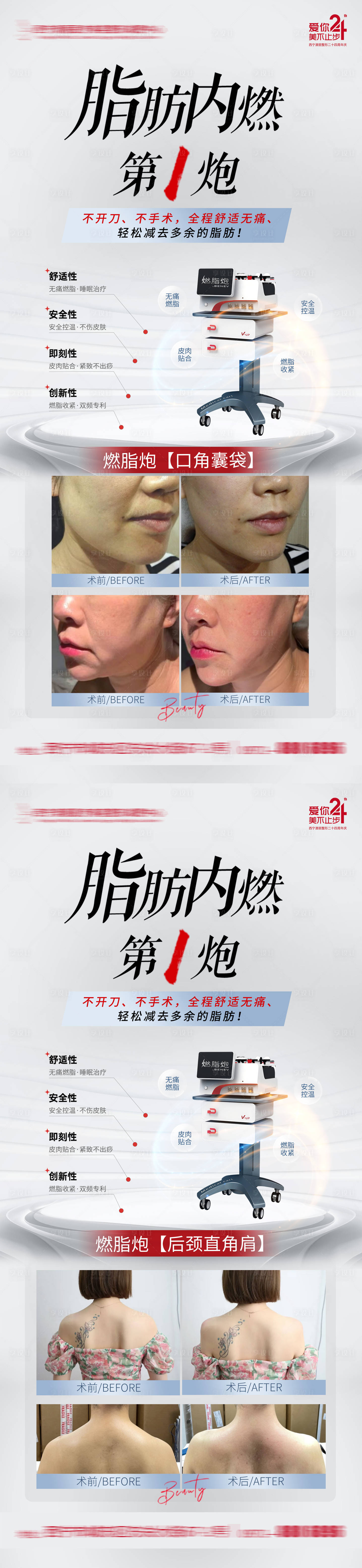 源文件下载【享设计】搜索编号：58470025356639051【医美仪器案例海报】