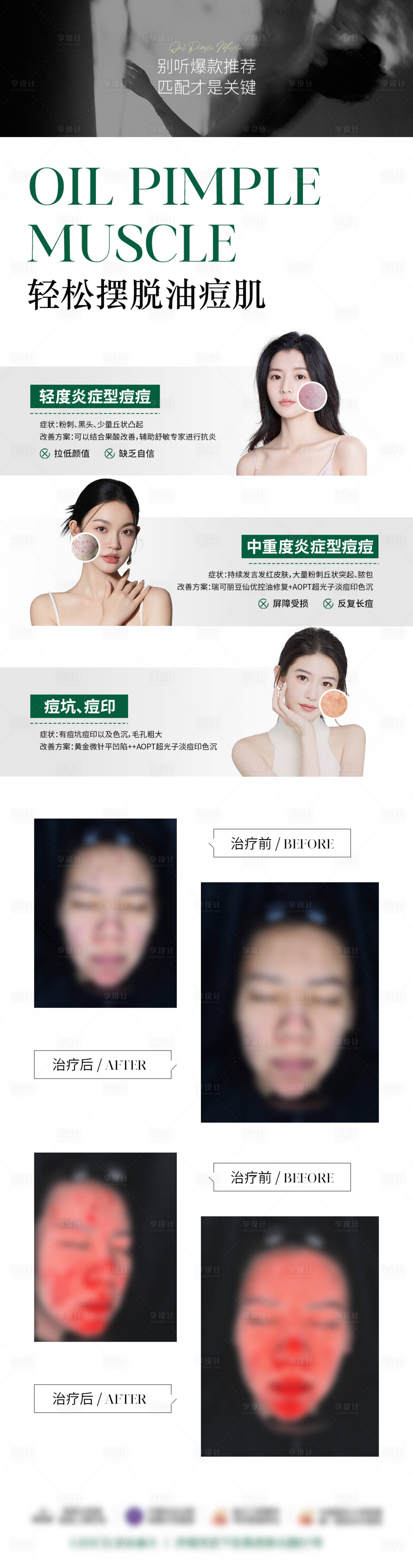 源文件下載【享設計】搜索編號：89130025156355740【輕松擺脫油痘肌海報】
