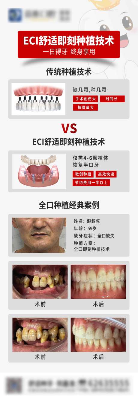 源文件下载【eci舒适种植牙】编号：19590025391136143