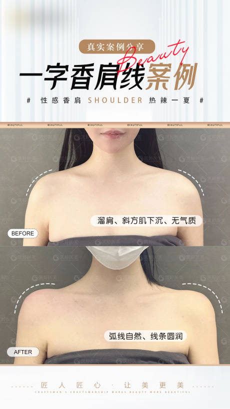 源文件下载【医美案例对比海报】编号：32460024901591606