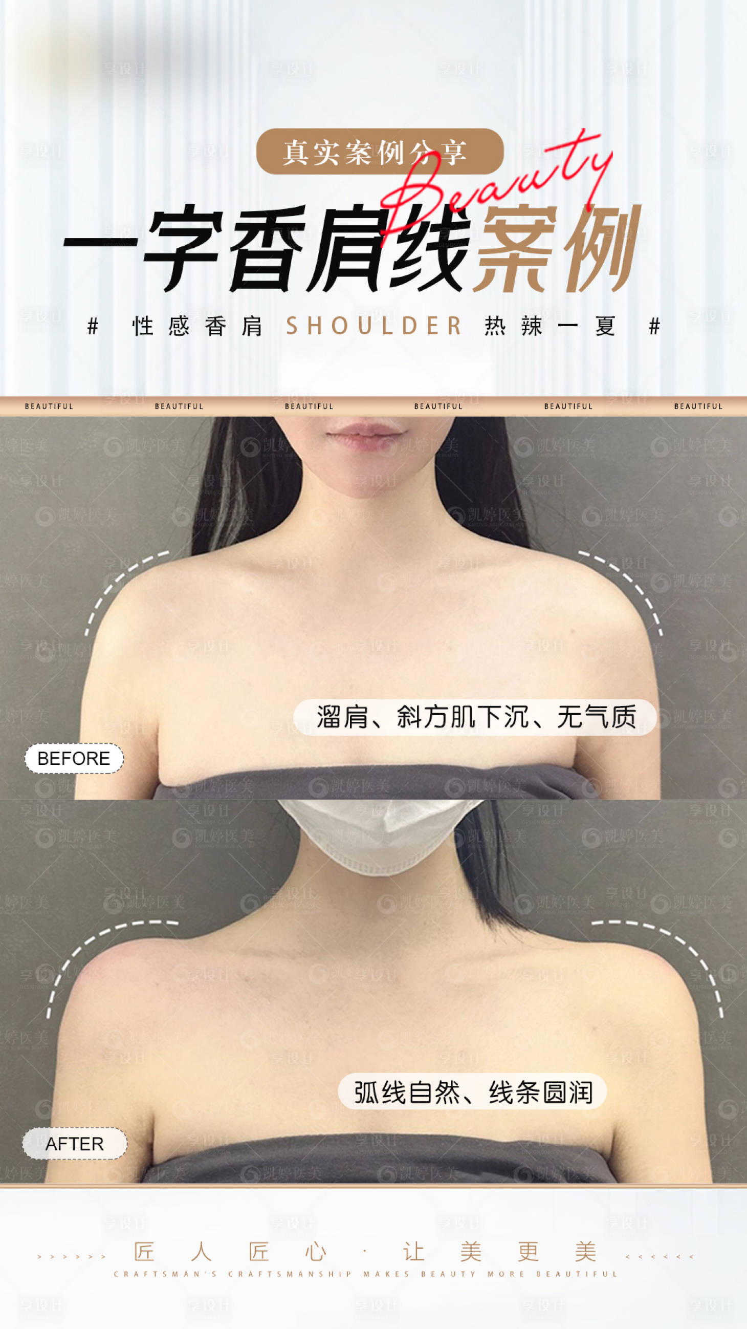 源文件下載【醫美案例對比海報】編號：32460024901591606
