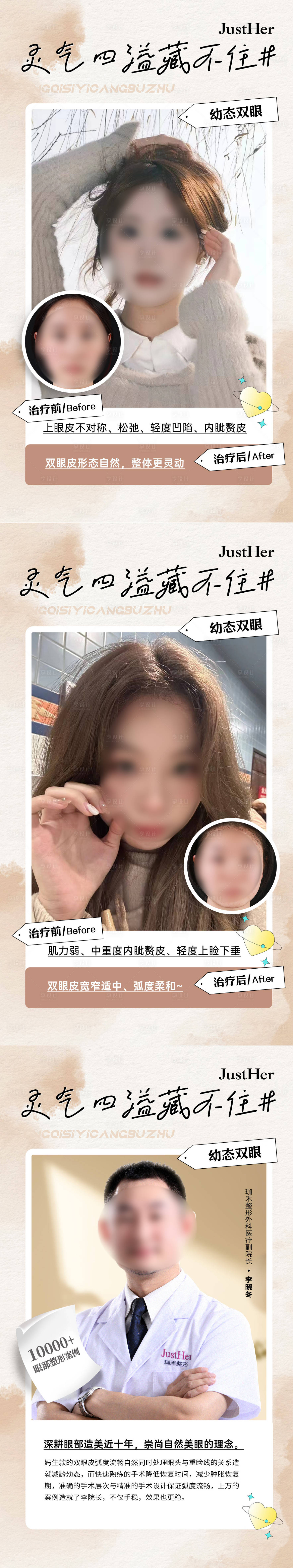 源文件下载【享设计】搜索编号：89780025263536297【双眼皮案例对比海报】